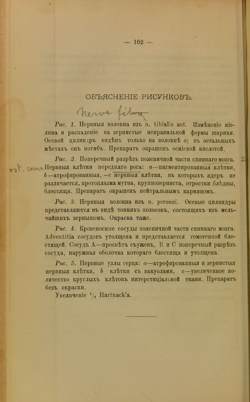 ОБЪЯСНЕНІЕ РИСУНКОВЪ. О'іх/ѵхл^ 'СгЛ'-’Ч- Рис. 1. Нервныя волокна изъ и. ііЬіаІіз ані. Измѣненіе міэ- лпна и раснадепіе на зернистые неправильной формы шарики. Осевой цплипдръ видѣнъ только па волокнѣ а; въ остальныхъ мѣстахъ онъ ногибъ. Препаратъ окрашенъ осміевой кислотой. Рис. 2. Поперечный разрѣзъ пояспичной части спиннаго мозга, ^ѵ.-. Нервныя клѣтки передняго рога: а—пигментированныя клѣтки, Ь—атрофированныя, —с нервныя клѣтки, въ которыхъ ядеръ не различается, протоплазма мутна, крупнозерниста, отростки блѣдны, блестящи. Препаратъ окрашенъ нейтральнымъ карминомъ. Рис. 3. Нервныя волокна изъ и. регопеі. Осевые цилиндры представляются въ видѣ тонкихъ полосокъ, состоящихъ изъ мель- чайшихъ зернышекъ. Окраска таже. Рис. 4. Кровеносные сосуды поясничной части спиннаго мозга. Айѵенііііа сосудовъ утолщена и представляется гомогенной бле- стящей. Сосудъ А—просвѣтъ съуженъ, В и С поперечный разрѣзъ сосуда, наружная оболочка котораго блестяща и утолщена. Рис. 5. Нервные узлы серца: а—атрофированныя п зернистыя нервныя клѣтки, Ь клѣтки съ вакуолями, с—увеличенное ко- личество круглыхъ клѣтокъ иптерстпціалі.ной ткани. Препаратъ безъ окраски. Увеличеніе 3/7 Нагінаск’а.