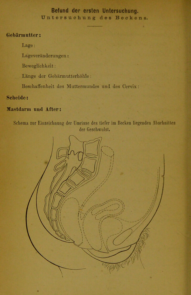 Untersuchung des Beckens. fiebüriiintter: Lage: Lageveränderungen: Beweglichkeit: Länge der Gebärmutterhöhle: Beschaffenheit des Muttermundes und des Cervix; Scheide; Mastdarin iiud After; Schema zur Einzcicliniing der Umrisse des tiefer im Becken liegenden Absclinitles der Geschwulst.