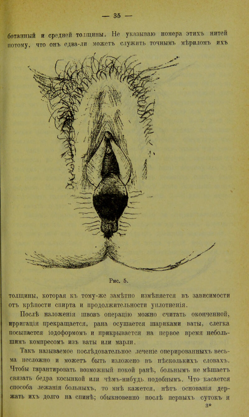 ботаггаый и средней толщины. Не указываю номера этихъ нитей потому, что онъ едва-ли можетъ служить точнымъ мѣриломъ ихъ Рис. 5. толщины, которая къ тому-же замѣтно измѣняется въ зависимости отъ крѣпости спирта и продолжительности уилотненія. Послѣ наложенія швовъ операцію можно считать оконченной, ирригація прекращается, рана осушается шариками ваты, слегка посыпается іодоформомъ и прикрывается на первое время неболь- шимъ компресомъ изъ ваты или марли. Такъ называемое послѣдовательное леченіе оперпрованныхъ весь- ма несложно и можетъ быть изложено въ нѣсколькихъ словахъ. Чтобы гарантировать возможный покой ранѣ, больнымъ не мѣшаетъ связать бедра косынкой или чѣмъ-нибудь подобнымъ. Что касается способа лежанія больныхъ, то мнѣ кажется, нѣтъ основанія дер- жать ихъ долго на спинѣ; обыкновенно послѣ первыхъ сутокъ я а*