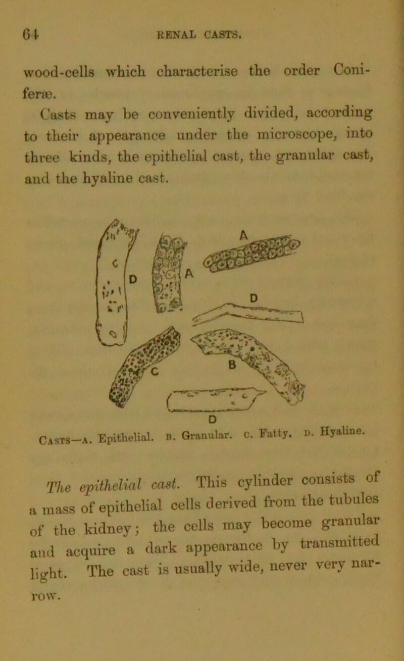 wood-cells which characterise the order Coni- ferte. Casts may be conveniently divided, according to their appearance under the microscope, into three kinds, the epithelial cast, the granular cast, and the hyaline cast. D Casts—A. Epithelial. B. Granular. C. Fatty. i>. Hyaline. The epithelial cast. This cylinder consists of a mass of epithelial cells derived from the tubules of the kidney; the cells may become granular and acquire a dark appearance by transmitted light. The cast is usually wide, never very nar- row.