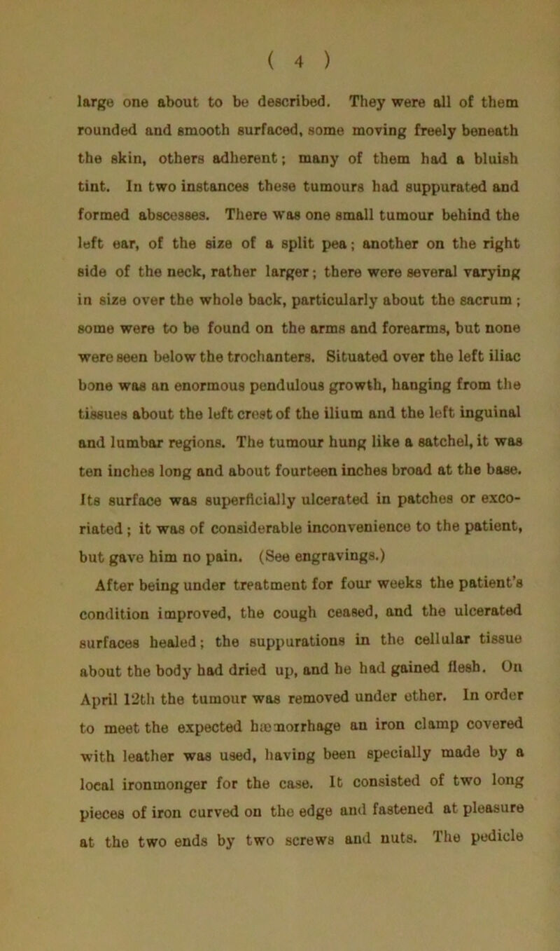 large one about to be described. They were all of them rounded and smooth surfaced, some moving freely beneath the skin, others adherent; many of them had a bluiBh tint. In two instances these tumours had suppurated and formed abscesses. There was one small tumour behind the left ear, of the size of a split pea; another on the right side of the neck, rather larger; there were several varying in size over the whole back, particularly about the sacrum ; some were to be found on the arms and forearms, but none were seen below the trochanters. Situated over the left iliac bone was an enormous pendulous growth, hanging from the tissues about the left crest of the ilium and the left inguinal and lumbar regions. The tumour hung like a satchel, it was ten inches long and about fourteen inches broad at the base. Its surface was superficially ulcerated in patches or exco- riated ; it was of considerable inconvenience to the patient, but gave him no pain. (See engravings.) After being under treatment for four weeks the patient’s condition improved, the cough ceased, and the ulcerated surfaces healed; the suppurations in the cellular tissue about the body had dried up, and he had gained flesh. On April 12th the tumour was removed under ether. In order to meet the expected haemorrhage an iron clamp covered with leather was used, having been specially made by a local ironmonger for the case. It consisted of two long pieces of iron curved on the edge and fastened at pleasure at the two ends by two screws and nuts. The pedicle