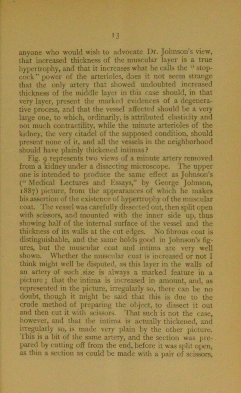 '3 anyone who would wish to advocate Dr. Johnson’s view, that increased thickness of the muscular layer is a true hypertrophy, and that it increases what he calls the “ stoi>- cock” power of the arterioles, does it not seem strange that the only arterj' that showed undoubted increased thickness of the middle layer in this case should, in that very layer, present the marked evidences of a degenera- tive j>rocess, and that the vessel affected should be a very large one, to which, ordinarily, is attributed elasticity and not much contractility, while the minute arterioles of the kidney, the very citadel of the supposed condition, should present none of if, and all the vessels in the neighborhood should have plainly thickened intimas? Fig. 9 represents two views of a minute artery removed from a kidney under a dissecting mi( rosco|)e. The upper one is intended to produce the same effect as Johnson's (“ Medical Lectures and Kssaj’s,” by (leorge Johnson, 1887) picture, from the appearances of which he makes his as.sertion of the existence of hy{)ertrophy of the muscular coat. The vessel was carefully dissected out, then split oi>en with scri.ssors, and mounted with the imier side up, thus showing half of the internal surface of the vessel and the thickness of its walls at the cut edges. No fibrous coat is distinguishable, and the same holds good in Johnson’s fig- ures, but the muscular coat and mtima are very well shown. Whether the muscular coat is increased or not I think might well lie disputed, as this layer in the walls of an artery of such .size is always a marked feature in a picture ; that the intima is increased in amount, and, as represented in the picture, irregidarly so, there can lie no doubt, though it might be said that this is due to the crude method of preparing the object, to dissect it out and then cut it with scissors. I'hat such is not the case, however, and that the intima is actually thickened, and irregularly so, is made very plain liy the other picture. 1 his is a bit of the same artery, and the section was pre- l>ared by cutting off from the end, before it w'as si>lit o{>en, as thin a section as could lie made with a pair of scissors.