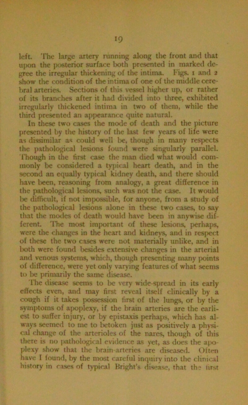 «9 left, 'fhe large artery running along the front and that upon the posterior surface both presented in marked de- gree the irregular thickening of the intima. Figs, i and 2 show the condition of the intima of one of the middle cere- bral arteries. Sections of this vessel higher up, or rather of its branches after it had divided into three, exhibited irregularly thickened intima in two of them, while the third presented an apjjearance quite natural. In these two cases the mode of death and the picture presented by the history of the last few years of life were as dissimilar as could well be, though in many respects the pathological lesions found were singularly pai^lel. Though in the first case the man died w’hat would com- monly be consideretl a tyj)ical heart death, and in the second an equally typical kidney death, and there should have l>een, reasoning from analc^, a great difference in the pathological lesions such was not the rase. It would l)e difficult, if not imix>ssible, for anyone, from a study of the pathological lesions alone in these two cases, to say that the mo<les of death would have been in anywise dif- ferent. 'lhe most important of these lesions, perhaj>s, were the changes in the heart and kidneys, and in respect of these the two cases were not nuterially unlike, and in Iwth were found besides extensive changes in the arterial and venous systems, which, though presenting many points of difference, were yet only varying features of what seems to lie primarily the same disease. 'llie <.lisea.se seems to be very wide-spread in its early effects even, and may first reveal itself clinically by a cough if it takes possession first of the lungs, or by the symptoms of apoplexy, if the brain arteries are the earli- est to suffer injur)', or by epistaxis perhaps, which has al- ways seemed to me to Iwtoken just as positively a physi- cal change of the arterioles of the nares, though of this there is no |»athoIogiral evidence as yet, as does the a)K>- plexy show that the brain arteries are disea.sc<l. Often have I found, by the mo.st careful inquiry into the clinical history in cases of typical Hright’s <1is<>ase, that th ? lirst