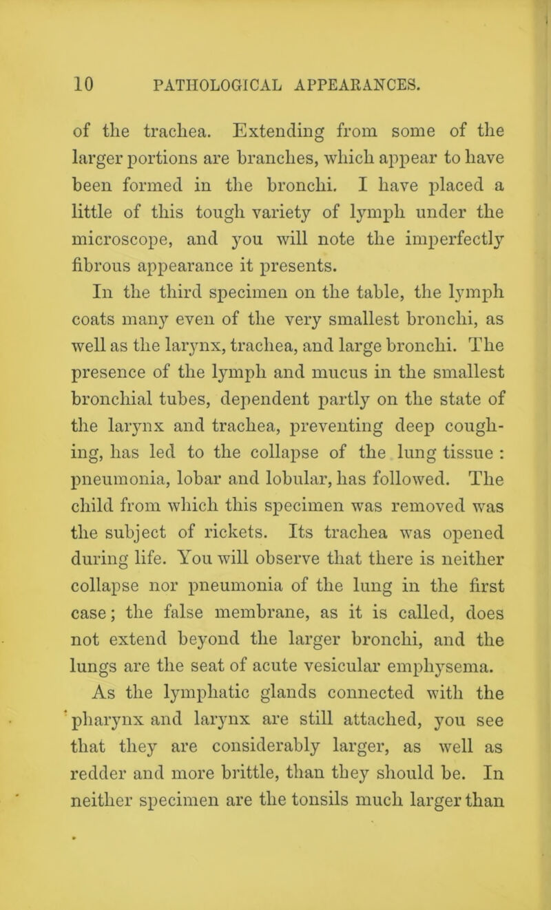 of the trachea. Extending from some of the larger portions are branches, which appear to have been formed in the bronchi. I have placed a little of this tough variety of lymph under the microscope, and you will note the imperfectly fibrous appearance it presents. In the third specimen on the table, the lymph coats many even of the very smallest bronchi, as well as the larynx, trachea, and large bronchi. The presence of the lymph and mucus in the smallest bronchial tubes, dependent partly on the state of the larynx and trachea, preventing deep cough- ing, has led to the collapse of the lung tissue : pneumonia, lobar and lobular, has followed. The child from which this specimen was removed was the subject of rickets. Its trachea was opened during life. You will observe that there is neither collapse nor pneumonia of the lung in the first case; the false membrane, as it is called, does not extend beyond the larger bronchi, and the lungs are the seat of acute vesicular emphysema. As the lymphatic glands connected with the pharynx and larynx are still attached, you see that they are considerably larger, as well as redder and more brittle, than they should be. In neither specimen are the tonsils much larger than