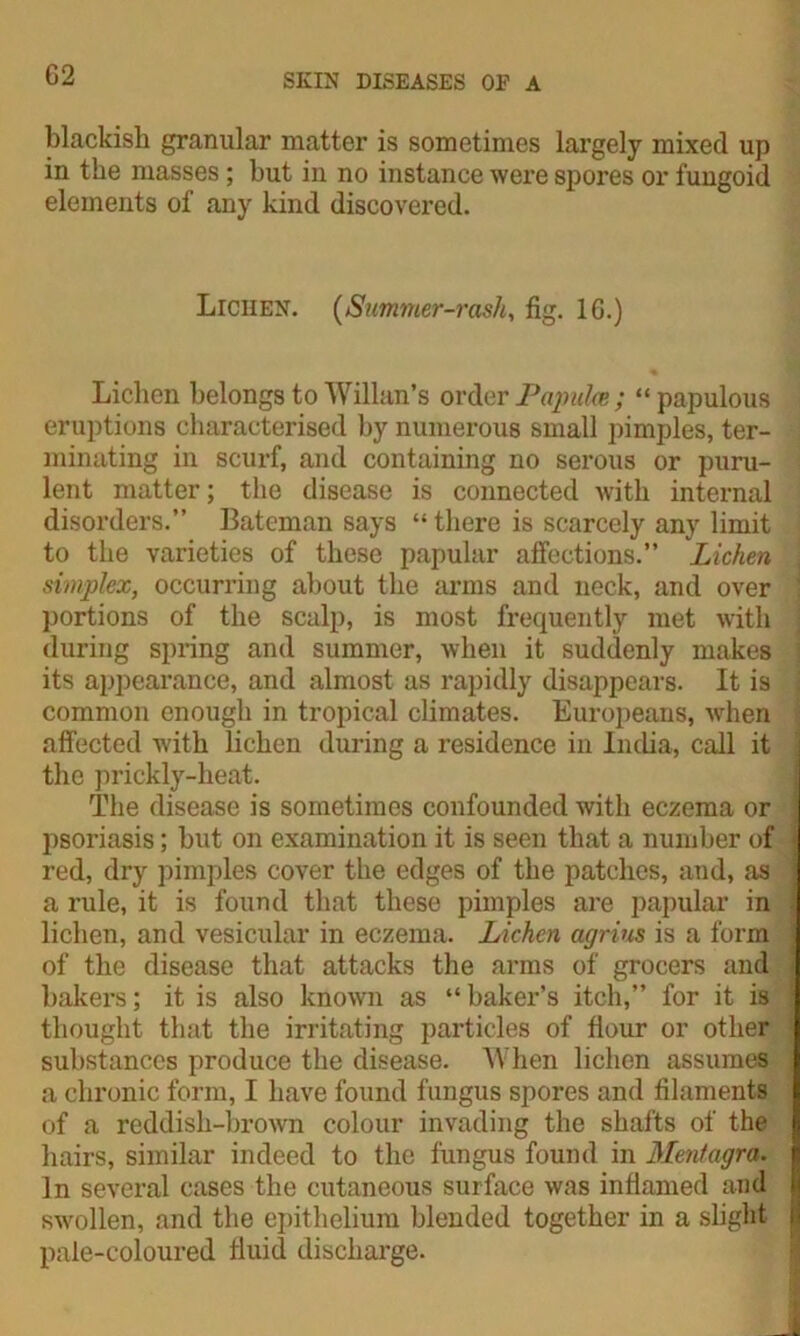 G2 blackish granular matter is sometimes largely mixed up in the masses; but in no instance were spores or fungoid elements of any kind discovered. Lichen. (Summer-rash, fig. 16.) Lichen belongs to Willan’s order Papula ; “papulous eruptions characterised by numerous small pimples, ter- minating in scurf, and containing no serous or puru- lent matter; the disease is connected with internal disorders.” Bateman says “ there is scarcely any limit to the varieties of these papular affections.” Lichen simplex, occurring about the arms and neck, and over portions of the scalp, is most frequently met with during spring and summer, when it suddenly makes its appearance, and almost as rapidly disappears. It is common enough in tropical climates. Europeans, when affected with lichen during a residence in India, call it the prickly-heat. The disease is sometimes confounded with eczema or psoriasis; hut on examination it is seen that a number of red, dry pimples cover the edges of the patches, and, as a rule, it is found that these pimples are papular in lichen, and vesicular in eczema. Lichen agrins is a form of the disease that attacks the arms of grocers and bakers; it is also known as “baker’s itch,” for it is thought that the irritating particles of flour or other substances produce the disease. When lichen assumes a chronic form, I have found fungus spores and filaments of a reddish-brown colour invading the shafts of the hairs, similar indeed to the fungus found in Mentagra. In several cases the cutaneous surface was inflamed and swollen, and the epithelium blended together in a slight pale-coloured fluid discharge.