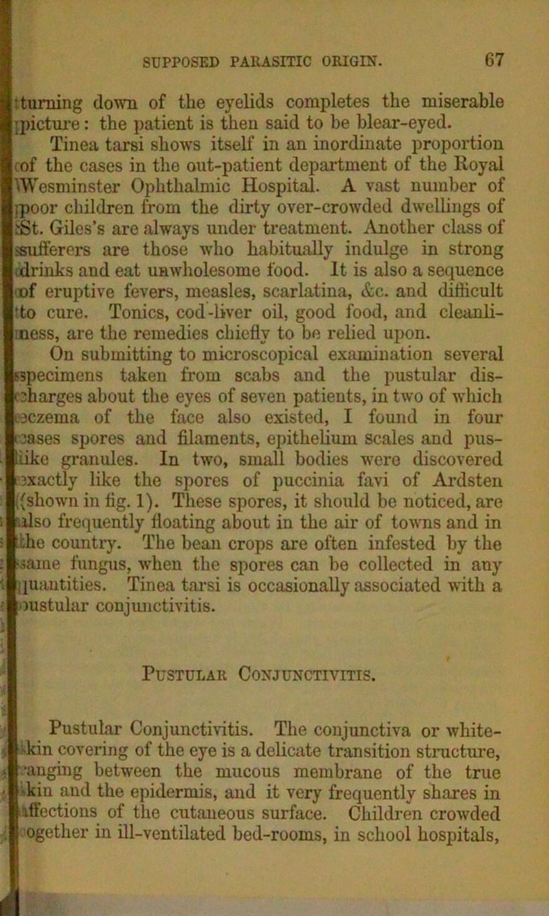 t turning down of the eyelids completes the miserable ■picture: the patient is then said to be blear-eyed. Tinea tarsi shows itself in an inordinate proportion c of the cases in the out-patient department of the Royal YWesminster Ophthalmic Hospital. A vast number of ipoor children from the dirty over-crowded dwellings of tSt. Giles’s are always under treatment. Another class of ssufferers are those who habitually indulge in strong ■drinks and eat unwholesome food. It is also a sequence oof eruptive fevers, measles, scarlatina, &c. and difficult •to cure. Tonics, cod-liver oil, good food, and cleanli- ness, are the remedies chiefly to be relied upon. On submitting to microscopical examination several specimens taken from scabs and the pustular dis- charges about the eyes of seven patients, in two of which eczema of the face also existed, I found in four leases spores and filaments, epithelium scales and pus- liikc granules. In two, small bodies were discovered exactly like the spores of puccinia favi of Ardsten ((shown in fig. 1). These spores, it should be noticed, are also frequently floating about in the air of towns and in tshe country. The bean crops are often infested by the ■iame fungus, when the spores can be collected in any quantities. Tinea tarsi is occasionally associated with a oustular conjunctivitis. Pustular Conjunctivitis. Pustular Conjunctivitis. The conjunctiva or white- diin covering of the eye is a delicate transition structure, anging between the mucous membrane of the true kin and the epidermis, and it very frequently shares in affections of the cutaneous surface. Children crowded ogether in ill-ventilated bed-rooms, in school hospitals,