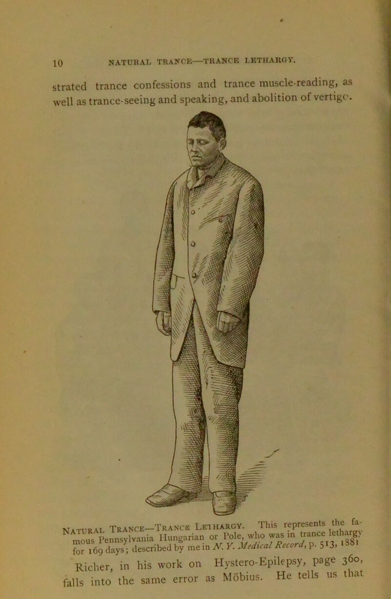 NATUHAIi TRAKCE—TRANCE LETHARGY. strated trance confessions and trance muscle-reading, as well as trance-seeing and speaking, and abolition of vertigo. Natural Trance—Trance Lethargy. This mous Pennsylvania Hungarian or Pole, who was in ‘ for 169 days; described by me in N. Y. Medical Record, p. 5 3» Richer, in his work on Hystero-Epilepsy, page 360, falls into the same error as Mobius. He tells us that