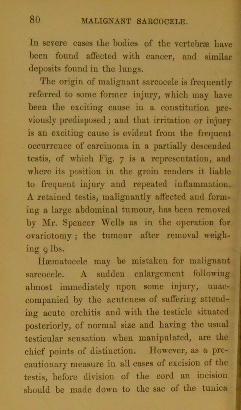 In severe cases tlie bodies of the vertebrae have been found affected with cancer, and similar deposits found in the lungs. The origin of malignant sarcocele is frequently referred to some former injury, which may have been the exciting cause in a constitution pre- viously predisposed; and that irritation or injury is an exciting cause is evident from the frequent occurrence of carcinoma in a partially descended testis, of which Fig. 7 is a representation, and where its position in the groin renders it liable to frequent injury aud repeated inflammation. A retained testis, malignantly affected and form- ing a large abdominal tumour, has been removed by Mr. Spencer Wells as in the operation for ovariotomy; the tumour after removal weigh- ing 9 lbs. Ilamiatocele may be mistaken for malignant sarcocele. A sudden enlargement following almost immediately upon some injury, unac- companied by the acuteness of suffering attend- ing acute orchitis and writh the testicle situated posteriorly, of normal size and having the usual testicular sensation when manipulated, are the chief points of distinction. However, as a pre- cautionary measure in all cases of excision of the testis, before division of the cord an incision should be made down to the sac of the tunica