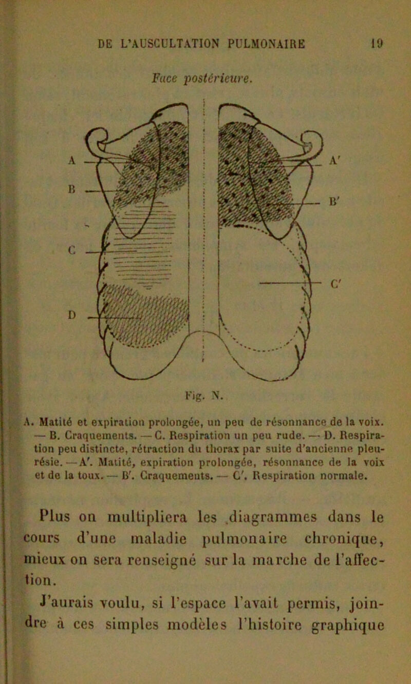 Face postérieure. A R G D Fig. N. A' B' C' A. Matité et expiration prolongée, un peu de résonnance de la voix. — B. Craquements. —C. Respiration un peu rude. — D. Respira- tion peu distincte, rétraction du thorax par suite d’ancienne pleu- résie.— A'. Matité, expiration prolongée, résonnance de la voix et de la toux.— B'. Craquements.— C'. Respiration normale. Plus on multipliera les .diagrammes dans le cours d’une maladie pulmonaire chronique, mieux on sera renseigné sur la marche de l’alTec- tion. J’aurais voulu, si l’espace l’avait permis, join- dre à ces simples modèles l’histoire graphique