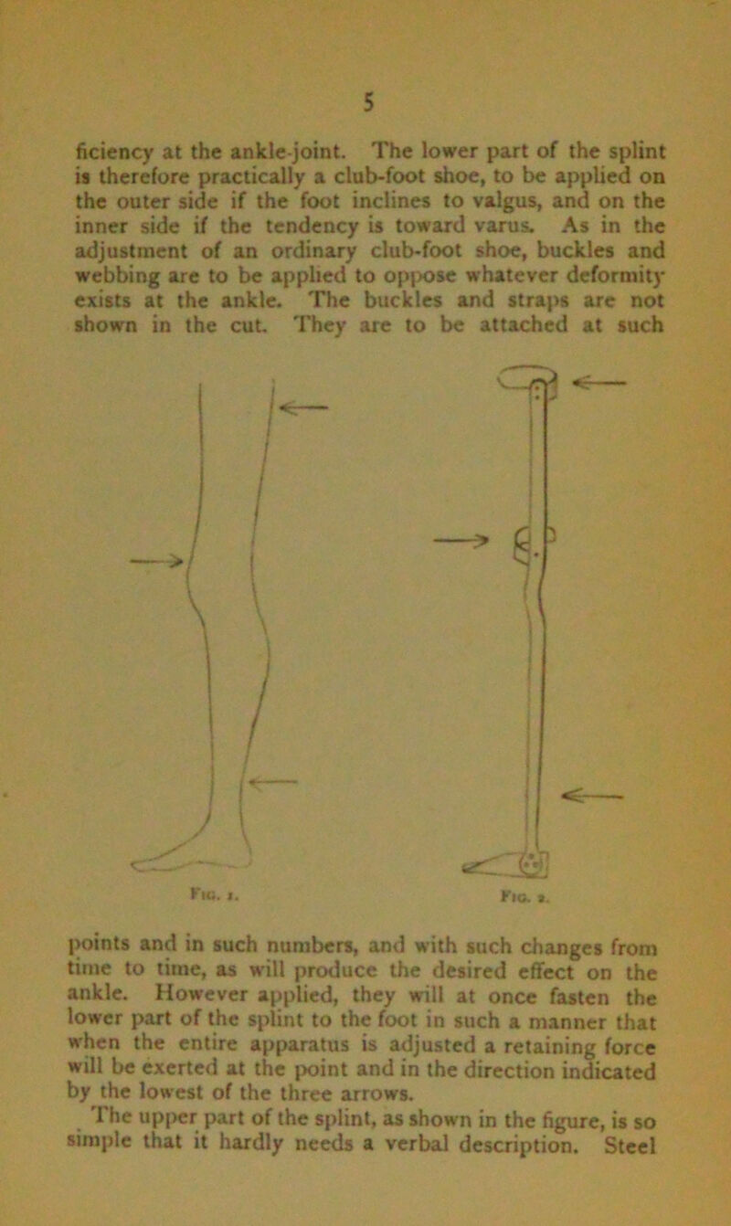 ficiency at the ankle-joint. The lower part of the splint is therefore practically a club-foot shoe, to be applied on the outer side if the foot inclines to valgus, and on the inner side if the tendency is toward varus. As in the adjustment of an ordinary club-foot shoe, buckles and webbing are to be applied to oppose whatever deformity exists at the ankle. The buckles and straps are not shown in the cut. They are to be attached at such !<: ! Fie. i. 00 Fio. a. points and in such numbers, and with such changes from time to time, as will produce the desired effect on the ankle. However applied, they will at once fasten the lower part of the splint to the foot in such a manner that when the entire apparatus is adjusted a retaining force will be exerted at the point and in the direction indicated by the lowest of the three arrows. The upper part of the splint, as shown in the figure, is so simple that it hardly needs a verbal description. Steel