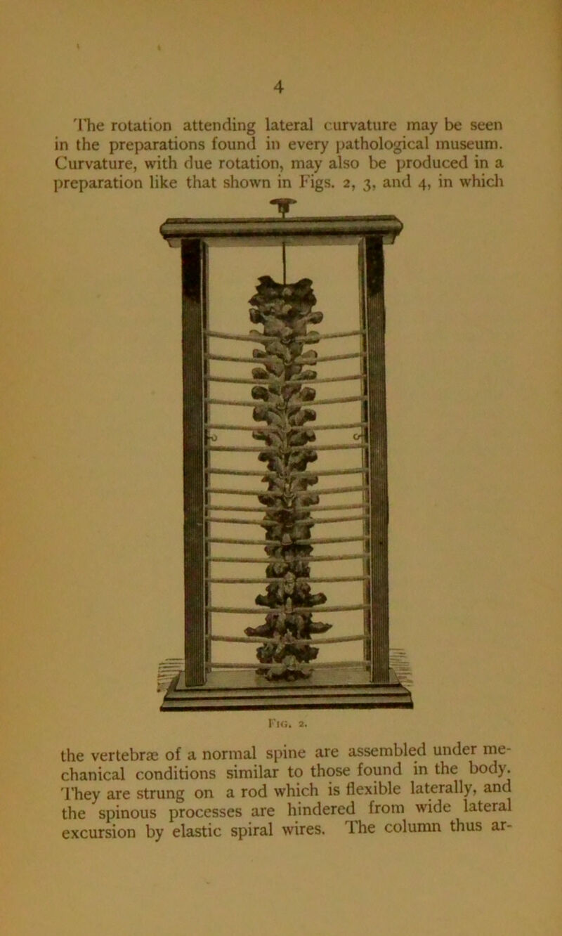 'I’he rotation attending lateral curvature may be seen in the preparations found in every pathological museum. Curvature, with due rotation, may also be produced in a preparation like that shown in Figs. 2, 3, and 4, in whicli -W* r’lo. 2. the vertebra: of a normal spine are assembled under me- chanical conditions similar to those found in the body. ITiey are strung on a rod which is flexible laterally, and the spinous processes are hindered from wide lateral excursion by elastic spiral wires. The column thus ar-