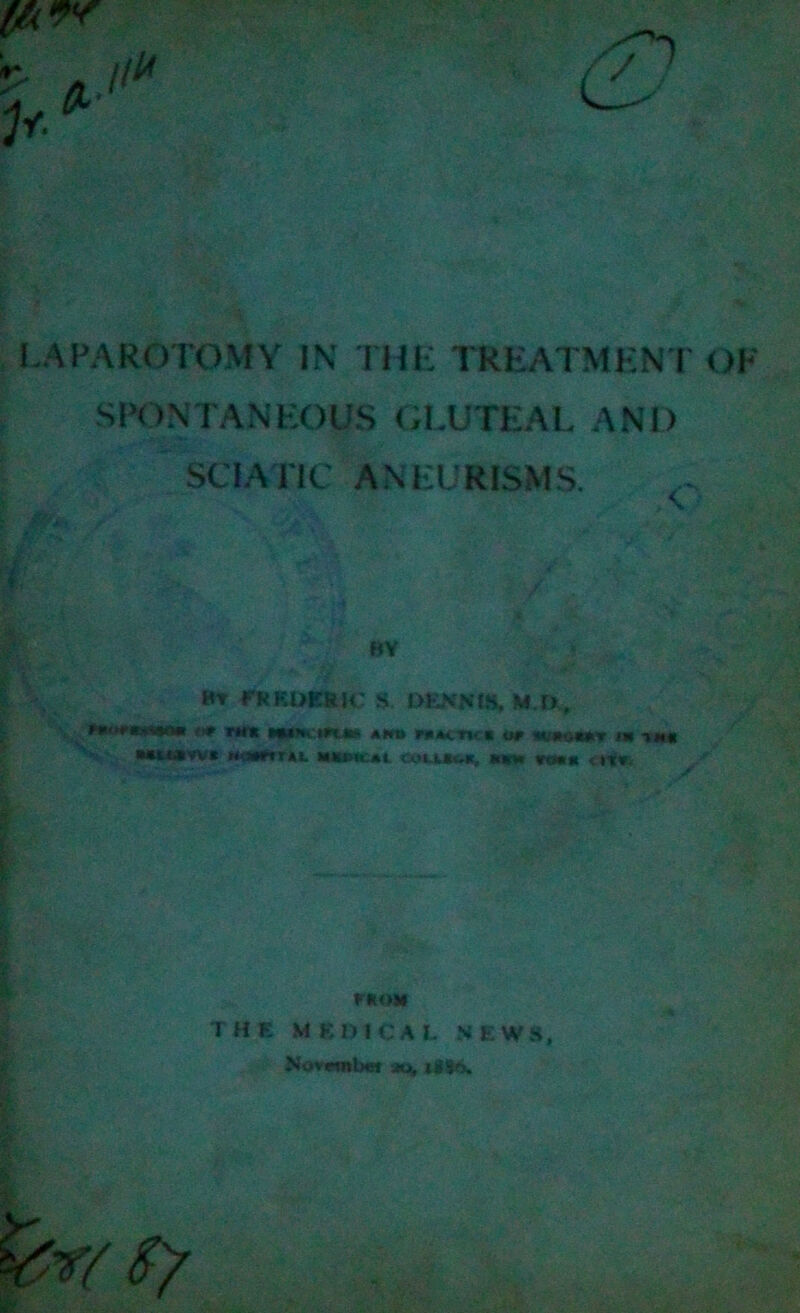 LAPAROTOMY IN THE TREATMENT OF SPONTANEOUS GLUTEAL AND SCIATIC ANEURISMS. ' •v- ® qfp* vb-id: •« BY Hr FREDERIC S DENNIS, M D, (I# r«ft Attn F»*cnc« or w»&m*v m ->«•« Mttavvt MnMiru MKixi.At ti»uiui. Hint m« <»■** 1 r«o* THE MEDICAL ne ws,