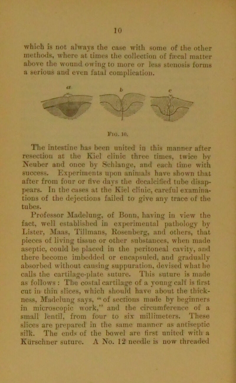 which is not always the case with some of the other methods, where at times the collection of fa-cal matter above the wound owing to more or less stenosis forms a serious and even fatal complication. Fio. to. The intestine has been united in this manner after resection at the Kiel clinic three times, twice by Neuber and once by Selllange, and each time with success. Experiments upon animals have shown that after from four or live days the decalcified tube disap- pears. In the cases at the Kiel clinic, careful examina- tions of the dejections failed to give any trace of the tubes. Professor Madelung, of Bonn, having in view the fact, well established in experimental pathology by Lister, Maas, Tillmans, Rosenberg, and others, that pieces of living tissue or other substances, when made aseptic, could be placed in the peritoneal cavity, and there become imbedded or encapsuled, and gradually absorbed without causing suppuration, devised what he calls the cartilage-plate suture. This suture is made as follows : The costal cartilage of a young calf is first cut in thin slices, which should have about the thick- ness, Madelung says, “ of sections made by beginners in microscopic work,” and the circumference of a small lentil, from four to six millimeters. These slices are prepared in the same manner as antiseptic silk. The ends of the bowel are first united with a Kiirschner suture. A No. 12 needle is now threaded