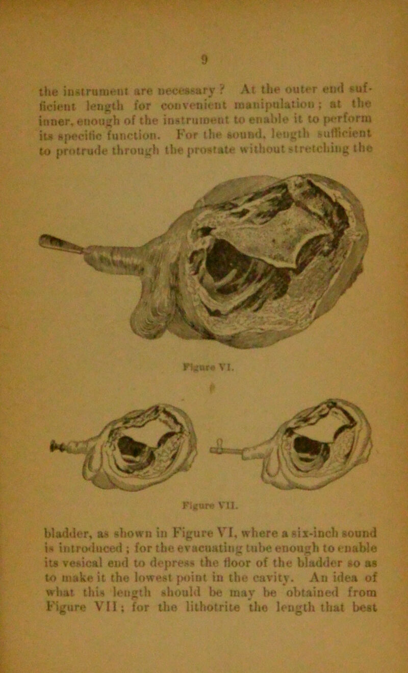 the instrument are necessary ? At the outer end suf- ficient length tor convenient manipulation; at the inner, enough of the instrument to enable it to perform its specific function. For the sound, length sufficient to protrude through the prostate without stretching the F!«ar* VI. Figure VII. bladder, as shown in Figure Vf, where a six-inch sound is introduced; for the evacuating tube enough to enable its vesical end to depress the floor of the bladder so as to make it the lowest point in the cavity. An idea of what this length should be raav be obtained from Figure VII; for the lithotrite the length that best