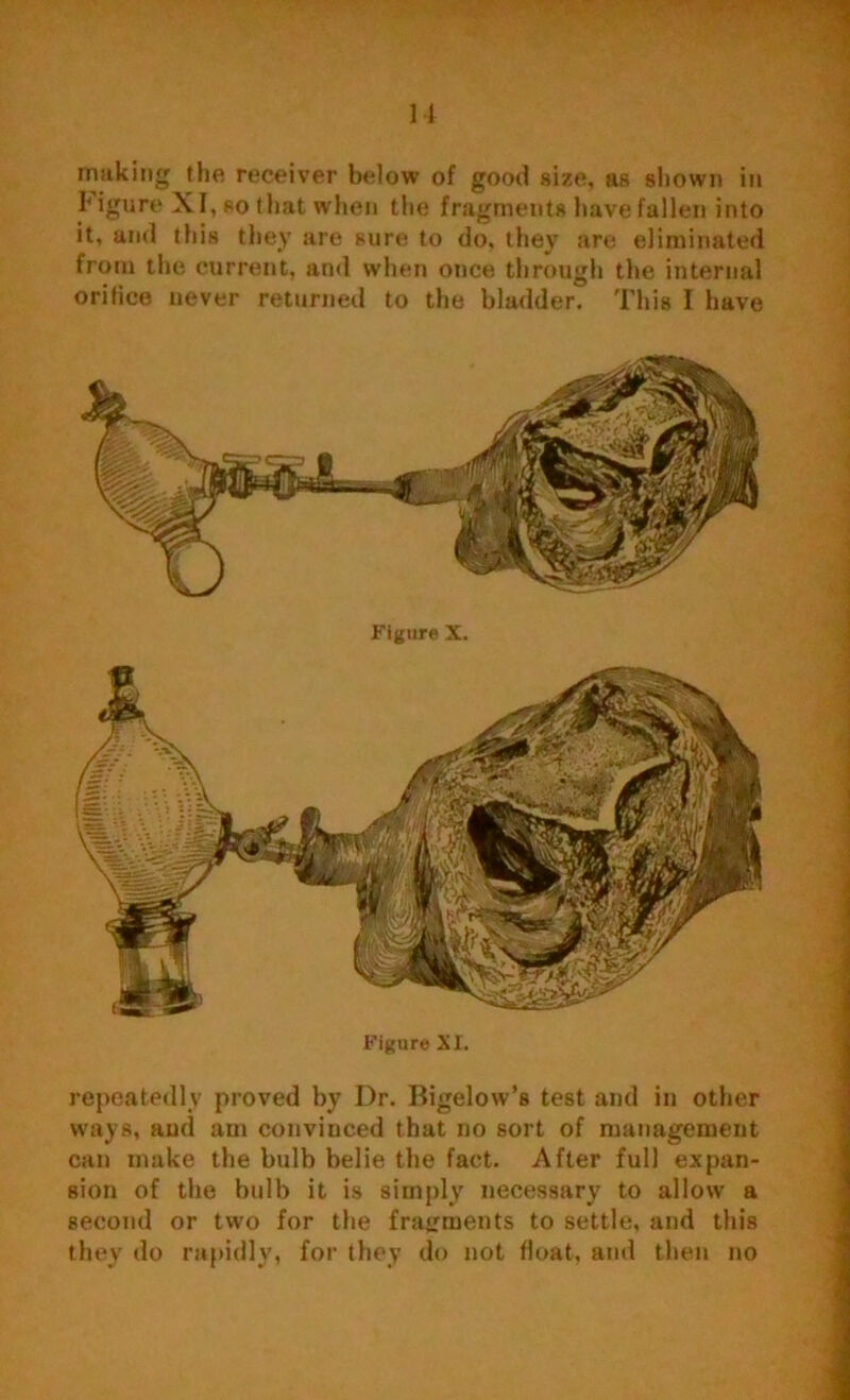making the receiver below of good size, as shown in Figure XI, so that when the fragments have fallen into it, and this they are sure to do, they are eliminated from the current, and when once through the internal orifice never returned to the bladder. This I have Figure X. Figure XI. repeatedly proved by Dr. Bigelow’s test and in other ways, and am convinced that no sort of management can make the bulb belie the fact. After full expan- sion of the bulb it is simply necessary to allow a second or two for the fragments to settle, and this they do rapidly, for they do not float, and then no
