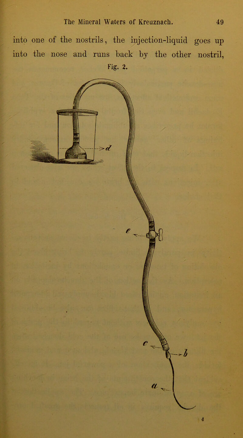 into one of the nostrils, the injection-liquid goes up into the nose and runs hack by the other nostril, Fig. 2. 4