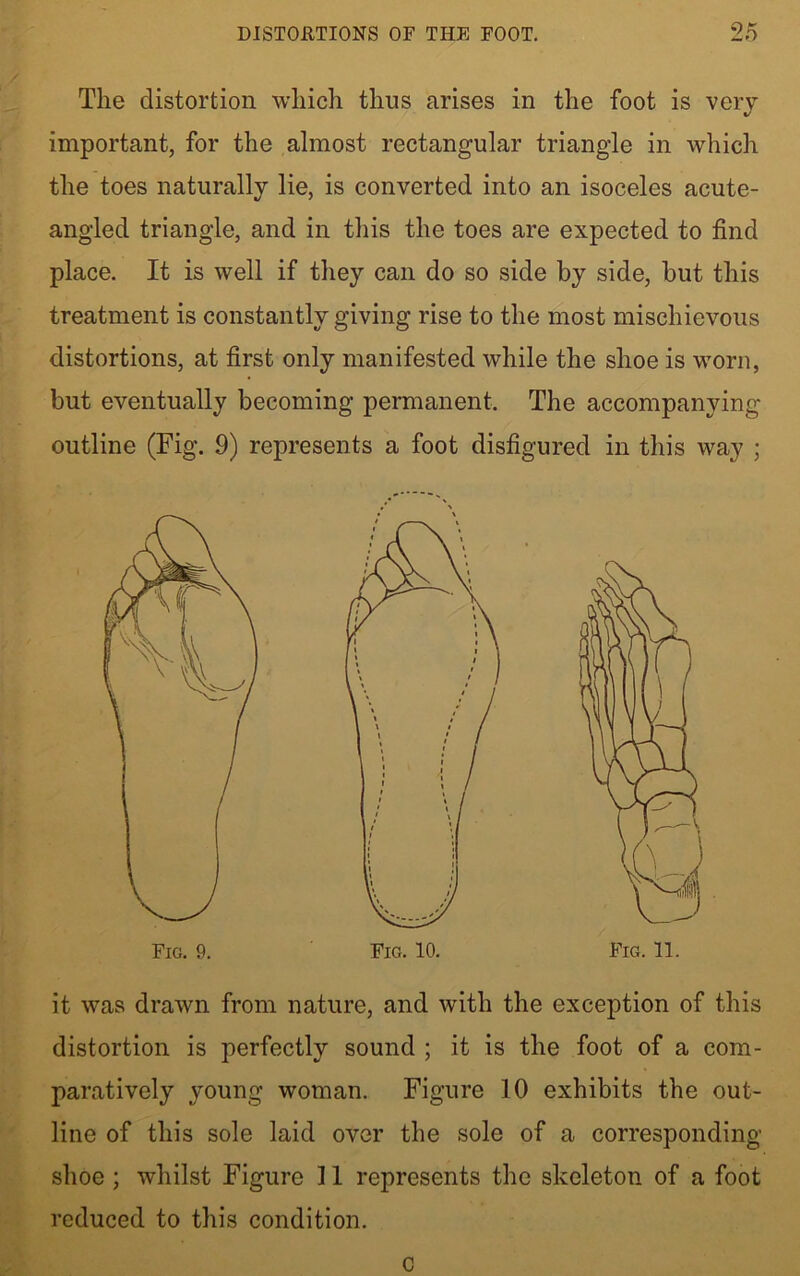 The distortion which thus arises in the foot is very important, for the almost rectangular triangle in which the toes naturally lie, is converted into an isoceles acute- angled triangle, and in this the toes are expected to find place. It is well if they can do so side by side, but this treatment is constantly giving rise to the most mischievous distortions, at first only manifested while the shoe is worn, but eventually becoming permanent. The accompanying outline (Fig. 9) represents a foot disfigured in this way ; Fig. 9. it was drawn from nature, and with the exception of this distortion is perfectly sound ; it is the foot of a com- paratively young woman. Figure 10 exhibits the out- line of this sole laid over the sole of a corresponding- shoe ; whilst Figure 11 represents the skeleton of a foot reduced to this condition. c