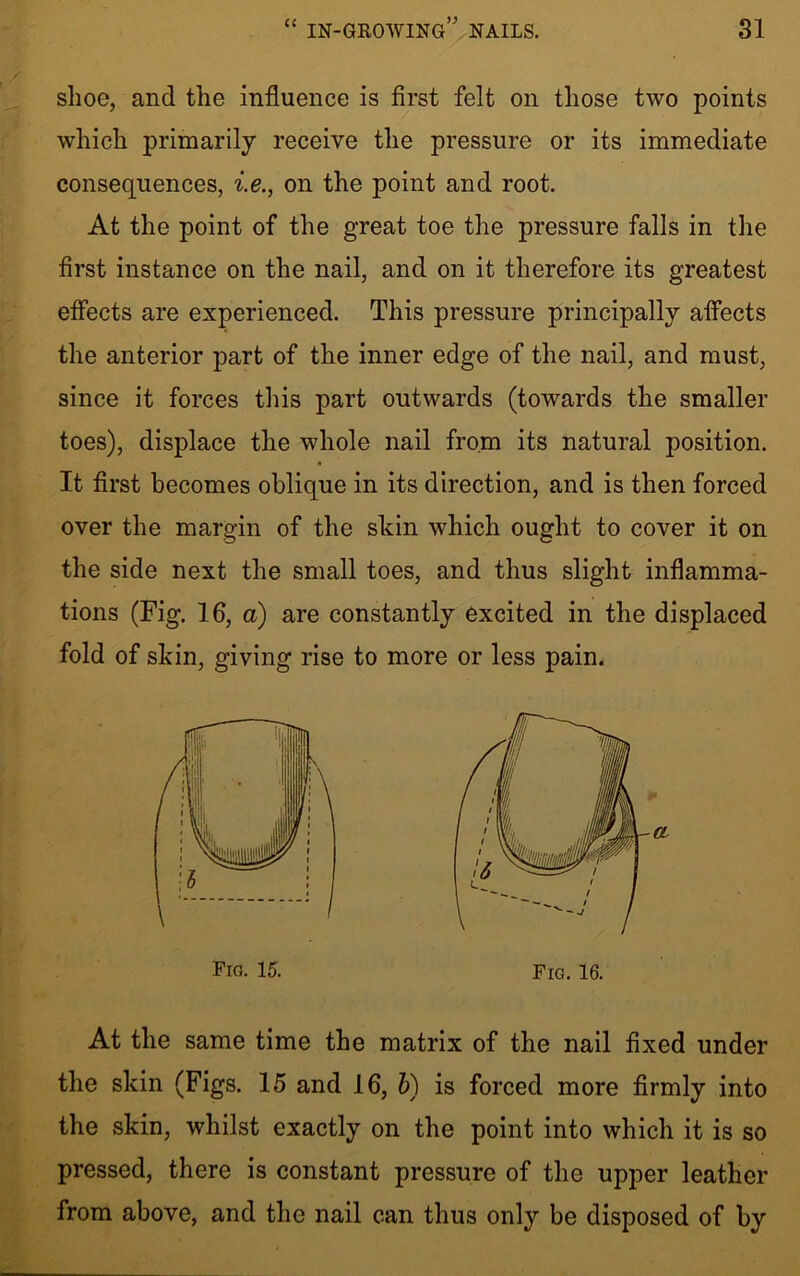 shoe, and the influence is first felt on those two points which primarily receive the pressure or its immediate consequences, i.e., on the point and root. At the point of the great toe the pressure falls in the first instance on the nail, and on it therefore its greatest effects are experienced. This pressure principally affects the anterior part of the inner edge of the nail, and must, since it forces this part outwards (towards the smaller toes), displace the whole nail from its natural position. It first becomes oblique in its direction, and is then forced over the margin of the skin which ought to cover it on the side next the small toes, and thus slight inflamma- tions (Fig. 16, a) are constantly excited in the displaced fold of skin, giving rise to more or less pain. At the same time the matrix of the nail fixed under the skin (Figs. 15 and 16, b) is forced more firmly into the skin, whilst exactly on the point into which it is so pressed, there is constant pressure of the upper leather from above, and the nail can thus only be disposed of by