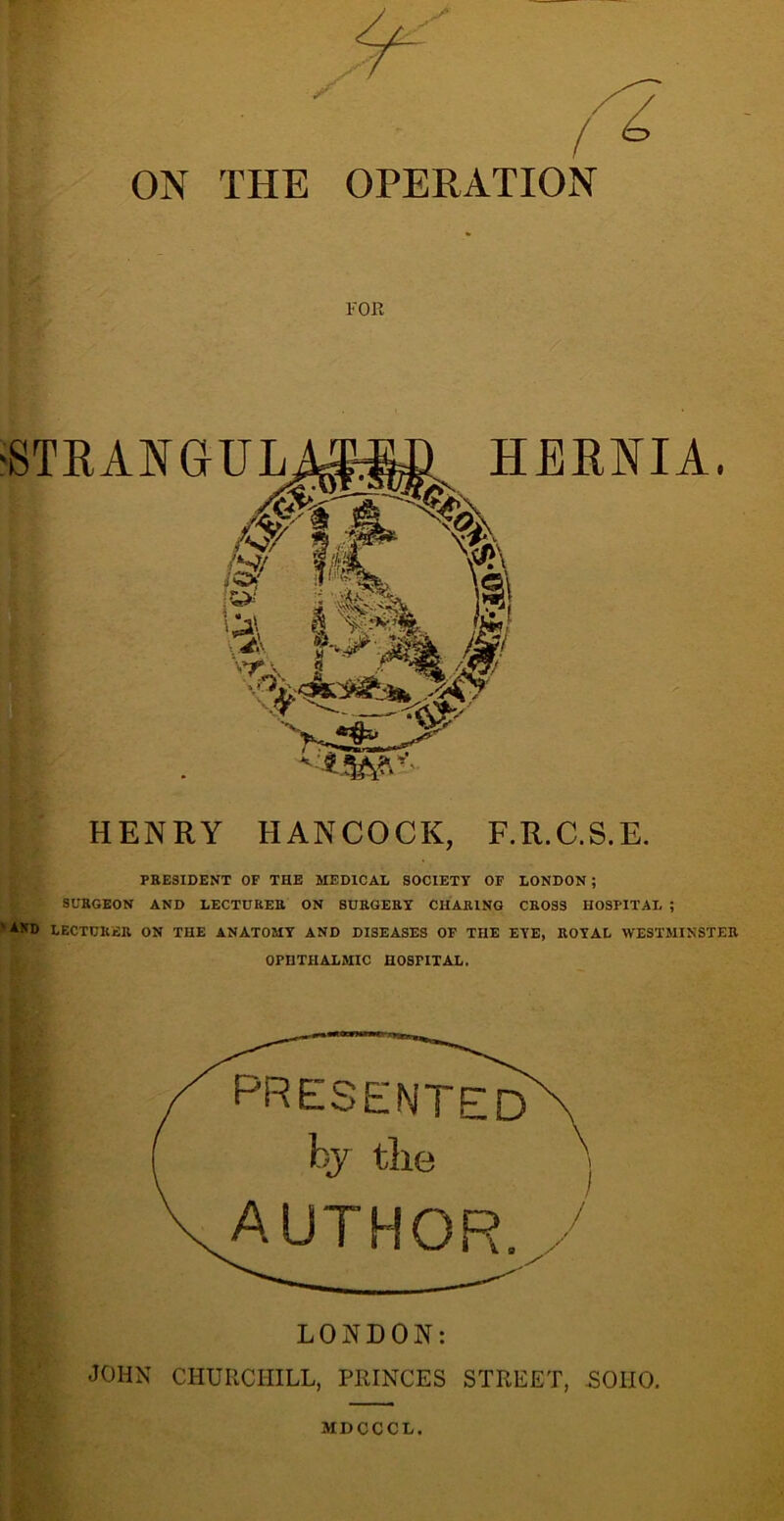 ON THE OPERATION FOR HENRY HANCOCK, F.R.C.S.E. PRESIDENT OF THE MEDICAL SOCIETY OF LONDON ; SURGEON AND LECTURER ON SURGERY CHARING CROSS HOSPITAL ; ' *ND LECTURER ON THE ANATOMY AND DISEASES OF THE EYE, ROYAL WESTMINSTER OPHTHALMIC HOSPITAL. LONDON: JOHN CHURCHILL, PRINCES STREET, SOHO. MDCCCL.