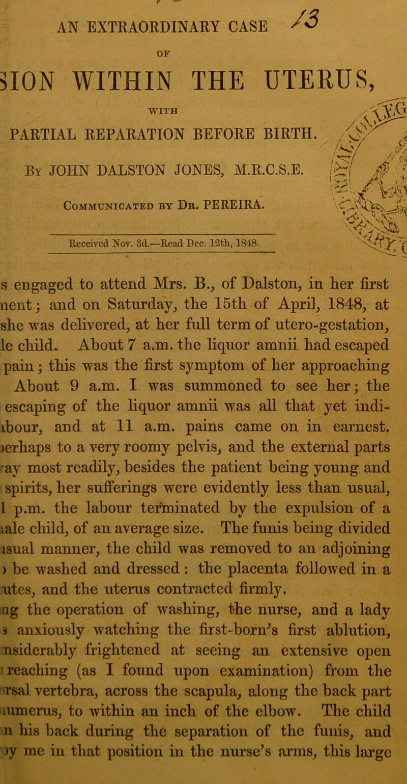 AN EXTRAORDINARY CASE OF nON WITHIN THE UTERUS, WITH PARTIAL REPARATION BEFORE BIRTH. By JOHN DALSTON JONES, M.R.C.S.E. Communicated by Dk. PEREIRA. Keceived Nov. 3d.—Read Dec. 12th, 1848. s engaged to attend Mrs. B., of Dalston, in her first nent; and on Saturday, the 15th of April, 1848, at she was delivered, at her full term of utero-gestation, le child. About 7 a.m. the liquor amnii had escaped pain; this was the first symptom of her approaching About 9 a.m. I was summoned to see her; the escaping of the liquor amnii was all that yet indi- ibour, and at 11 a.m. pains came on in earnest. )erhaps to a very roomy pelvis, and the external parts ^ay most readily, besides the patient being young and spirits, her sufferings were evidently less than usual, I p.m. the labour terminated by the expulsion of a lale child, of an average size. The funis being divided isual manner, the child was removed to an adjoining ) be washed and dressed: the placenta followed in a utes, and the uterus contracted firmly. Qg the operation of washing, the nurse, and a lady 3 anxiously watching the first-born^s first ablution, nsiderably frightened at seeing an extensive open : reaching (as I found upon examination) from the •irsal vertebra, across the scapula, along the back part lumerus, to within an inch of the elbow. The child n his back during the separation of the funis, and )y me in that position in the nurse’s arms, this large ,.c? - s'