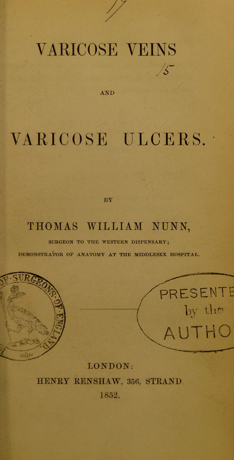 VARICOSE VEINS AND VARICOSE ULCERS. BY THOMAS WILLIAM NUNN, SURGEON TO THE WESTERN DISPENSARY; DEMONSTRATOR OF ANATOMY AT THE MIDDLESEX HOSPITAL. LONDON: HENRY RENSHAW, 356, STRAND 1852. rn