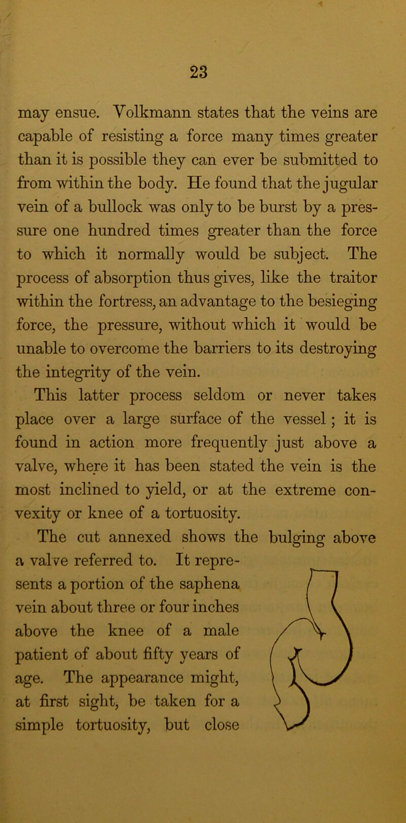 may ensue. Volkmann states that the veins are capable of resisting a force many times greater than it is possible they can ever be submitted to from within the body. He found that the jugular vein of a bullock was only to be burst by a pres- sure one hundred times greater than the force to which it normally would be subject. The process of absorption thus gives, like the traitor within the fortress, an advantage to the besieging force, the pressure, without which it would be unable to overcome the barriers to its destroying the integrity of the vein. This latter process seldom or never takes place over a large surface of the vessel; it is found in action more frequently just above a valve, where it has been stated the vein is the most inclined to yield, or at the extreme con- vexity or knee of a tortuosity. The cut annexed shows the bulging above a valve referred to. It repre- sents a portion of the saphena vein about three or four inches above the knee of a male patient of about fifty years of age. The appearance might, at first sight, be taken for a simple tortuosity, but close