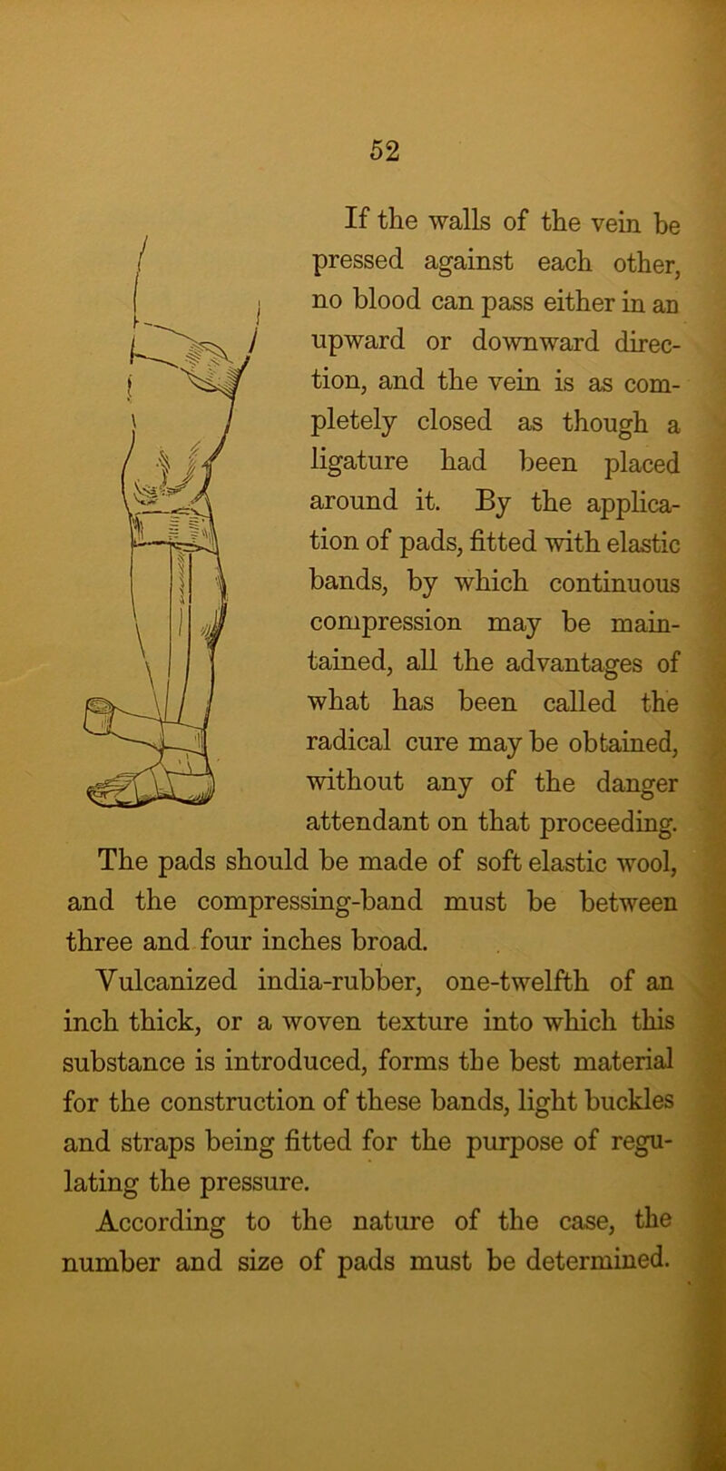 If the walls of the vein be pressed against each other, no blood can pass either in aD upward or downward direc- tion, and the vein is as com- pletely closed as though a ligature had been placed around it. By the applica- tion of pads, fitted with elastic bands, by which continuous compression may be main- tained, all the advantages of what has been called the radical cure may be obtained, without any of the danger attendant on that proceeding. The pads should be made of soft elastic wool, and the compressing-band must be between three and four inches broad. Vulcanized india-rubber, one-twelfth of an inch thick, or a woven texture into which this substance is introduced, forms the best material for the construction of these bands, light buckles and straps being fitted for the purpose of regu- lating the pressure. According to the nature of the case, the number and size of pads must be determined.