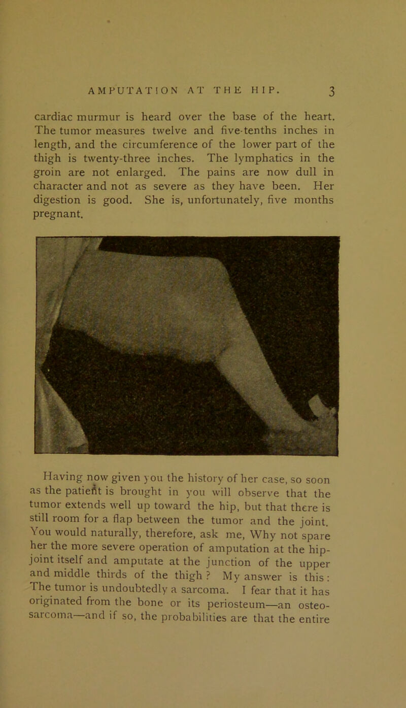 cardiac murmur is heard over the base of the heart. The tumor measures twelve and five-tenths inches in length, and the circumference of the lower part of the thigh is twenty-three inches. The lymphatics in the groin are not enlarged. The pains are now dull in character and not as severe as they have been. Her digestion is good. She is, unfortunately, five months pregnant. Having now given you the history of her case, so soon as the patief^t is brought in you will observe that the tumor extends well up toward the hip, but that there is still room for a flap between the tumor and the joint. You would naturally, therefore, ask me. Why not spare her the more severe operation of amputation at the hip- joint itself and amputate at the junction of the upper and middle thirds of the thigh ? My answer is this : The tumor is undoubtedly a sarcoma. 1 fear that it has originated from the bone or its periosteum—an osteo- sarcoma and if so, the probabilities are that the entire