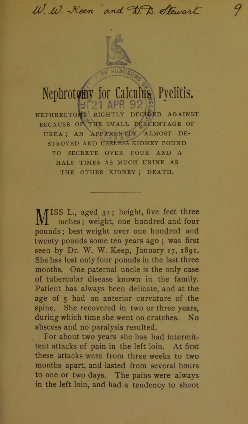 MJ- ->KeArt OyncC STROYED AND USELESS KIDNEY FOUND TO SECRETE OVER FOUR AND A HALF TIMES AS MUCH URINE AS THE OTHER KIDNEY ; DEATH. MISS L., aged 31; height, five feet three inches; weight, one hundred and four pounds; best weight over one hundred and twenty pounds some ten years ago ; was first seen by Dr. W. W. Keep, January 17, 1891. She has lost only four pounds in the last three months. One paternal uncle is the only case of tubercular disease known in the family. Patient has always been delicate, and at the age of 5 had an anterior curvature of the spine. She recovered in two or three years, during which time she went on crutches. No abscess and no paralysis resulted. For about two years she has had intermit- tent attacks of pain in the left loin. At first these attacks were from three weeks to two months apart, and lasted from several hours to one or two days. The pains were always in the left loin, and had a tendency to shoot