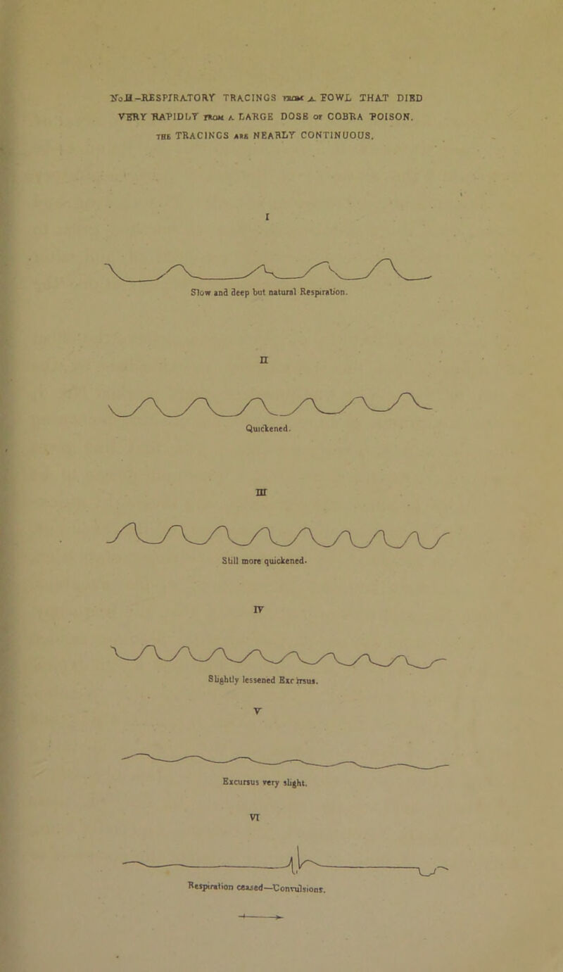 lToJi-R£SPrRA.TORr TRACINGS tucm^TOWL THAT DIED VERY TIATIDLT rnou k LARGE DOSE or COBRA TOISON. 7H£ TRACINGS AM nearly CONTINUOUS. I Slow and deep but natural Respiralion. n Quickened. nr suit more quickened- lY SlighUy lessened Bxrbrsui. V Eicursus T«ry slight. vr Respiration ceased—Connilsionr.