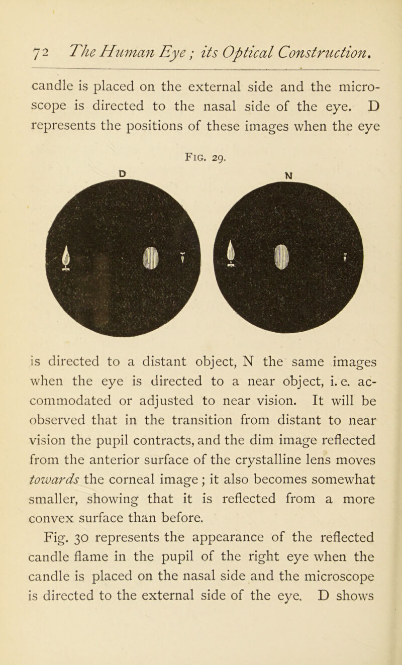 candle is placed on the external side and the micro- scope is directed to the nasal side of the eye. D represents the positions of these images when the eye Fig. 29. D M is directed to a distant object, N the same images when the eye is directed to a near object, i. e. ac- commodated or adjusted to near vision. It will be observed that in the transition from distant to near vision the pupil contracts, and the dim image reflected from the anterior surface of the crystalline lens moves towards the corneal image; it also becomes somewhat smaller, showing that it is reflected from a more convex surface than before. Fig. 30 represents the appearance of the reflected candle flame in the pupil of the right eye when the candle is placed on the nasal side and the microscope is directed to the external side of the eye. D shows