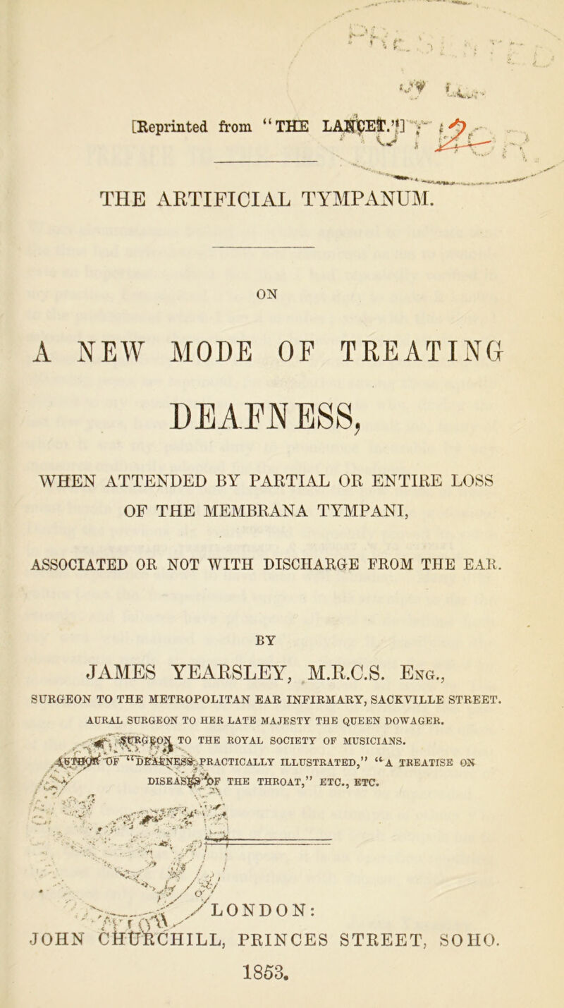 f. ♦ A*>«  ... v tv** • V' tjy i, [Reprinted from “THE LAlTpEff.’J] V | THE ARTIFICIAL TYMPANUM. ON A NEW MODE OF TREATING DEAFNESS, WHEN ATTENDED BY PARTIAL OR ENTIRE LOSS OF THE MEMBRANA TYMPANI, ASSOCIATED OR NOT WITH DISCHARGE FROM THE EAR. BY JAMES YEARSLEY, M.R.C.S. Eng., SURGEON TO THE METROPOLITAN EAR INFIRMARY, SACKVILLE STREET. AURAL SURGEON TO HER LATE MAJESTY THE QUEEN DOWAGER. ^r^^TO THE royal society of musicians. ^PRACTICALLY ILLUSTRATED,” {tA TREATISE ON ;/>Y DISEAS^J'VOF THE THROAT,” ETC., ETC.  . ?.v \ ■j y 40^^’ *71  ■ :» -ihf' i I Nj; pf / v, ‘’/f/v*/ ■y^^y LONDON JOHN CHtJRCHILL, PRINCES STREET, SOHO. 1853.