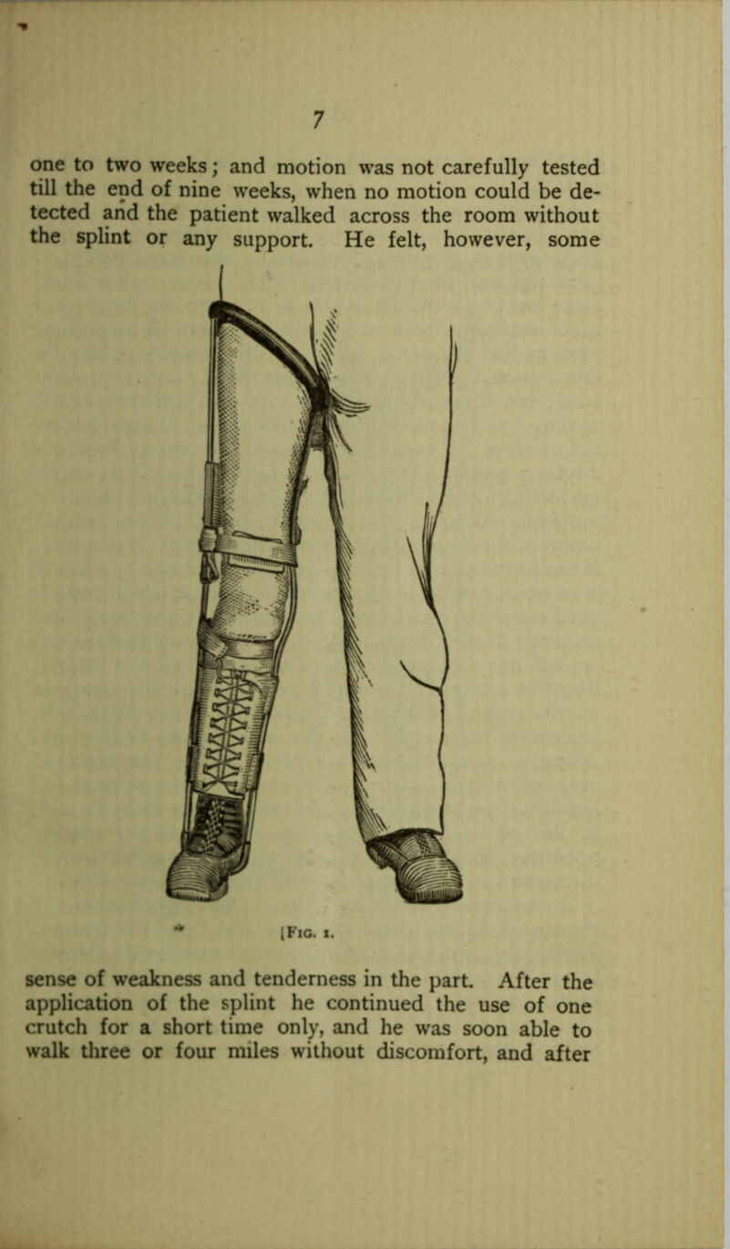 one to two weeks; and motion was not carefully tested till the end of nine weeks, when no motion could be de- tected and the patient walked across the room without the splint or any support. He felt, however, some [Fig. s. sense of weakness and tenderness in the part. After the application of the splint he continued the use of one crutch for a short time only, and he was soon able to walk three or four miles without discomfort, and after