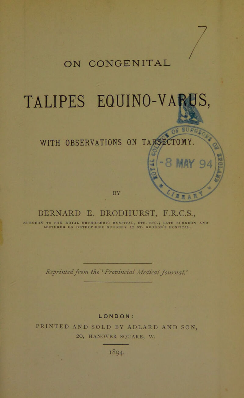 7 / ON CONGENITAL TALIPES EQUINO-VA BERNARD E. BRODHURST, F.R.C.S., 3UBGEON TO THE ROYAL ORTIIOPJiDIC HOSPITAL, ETC. BTC.; LATE SUROEO?( ANH LECTUUEK UN ORTHOP.EHIC SUUUEUY AT ST. UEOHUB’s HOSPITAL. Reprinted from the ‘ Provincial Medical Journal. ’ LONDON; PRINTED AND SOLD BY ADLARD AND SON, 20, HANOVER SQUARE, \V. 1894.