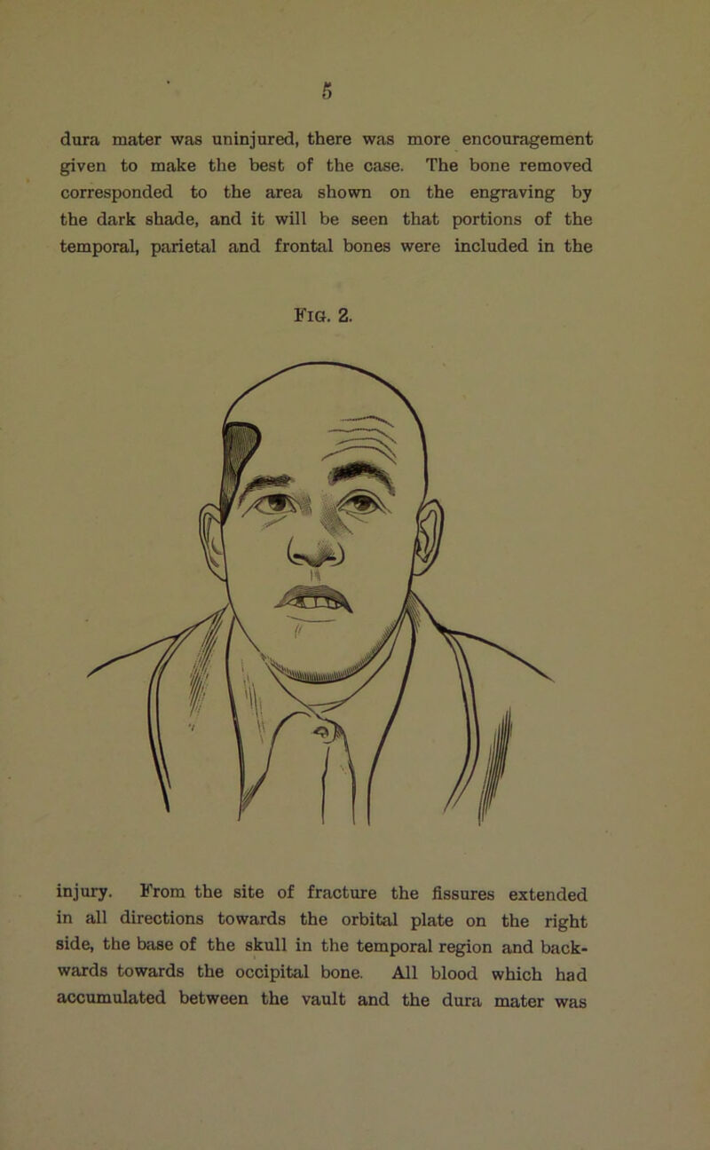dura mater was uninjured, there was more encouragement given to make the best of the case. The bone removed corresponded to the area shown on the engraving by the dark shade, and it will be seen that portions of the temporal, parietal and frontal bones were included in the ITS. 2. injury. From the site of fracture the fissures extended in all directions towards the orbital plate on the right side, the base of the skull in the temporal region and back- wards towards the occipital bone. All blood which had accumulated between the vault and the dura mater was