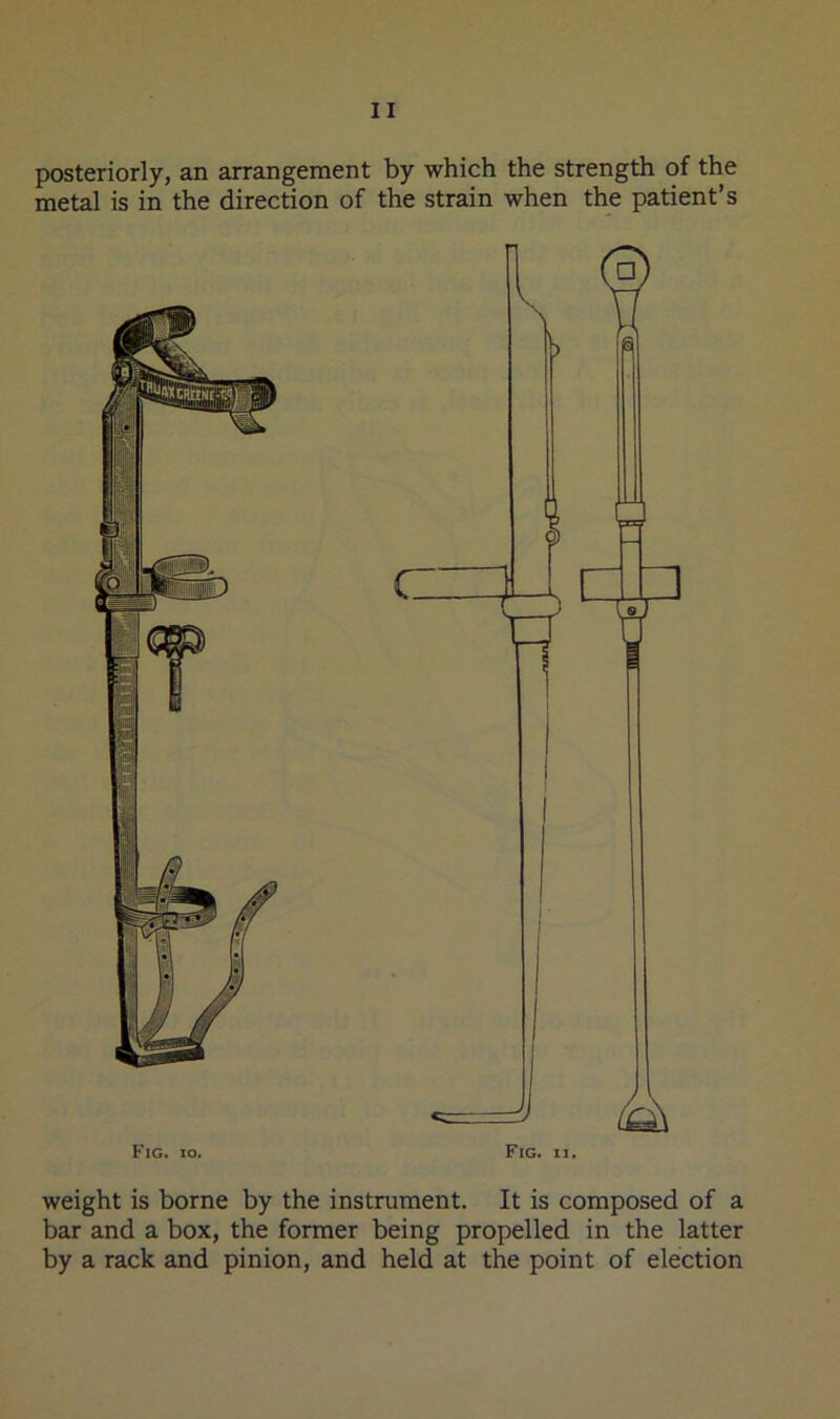 posteriorly, an arrangement by which the strength of the metal is in the direction of the strain when the patient’s weight is borne by the instrument. It is composed of a bar and a box, the former being propelled in the latter by a rack and pinion, and held at the point of election