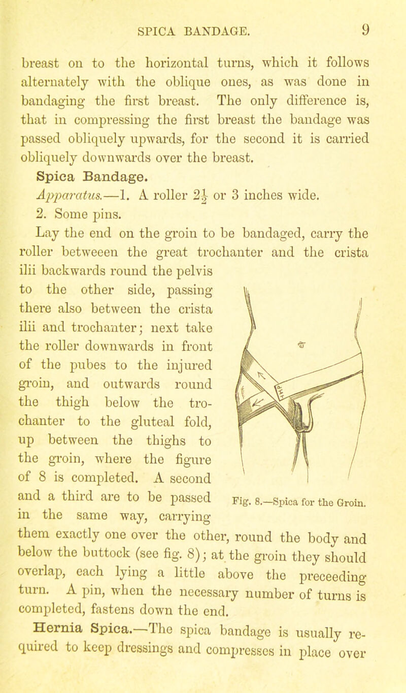 breast on to the horizontal turns, which it follows alternately with the oblique ones, as was done in bandaging the first breast. The only difference is, that in compressing the first breast the bandage was passed obliquely upwards, for the second it is carried obliquely downwards over the breast. Spica Bandage. Apparatus.—1. A roller 2| or 3 inches wide. 2. Some pins. Lay the end on the groin to be bandaged, carry the roller betweeen the great trochanter and the crista ilii backwards round the pelvis to the other side, passing there also between the crista ilii and trochanter; next take the roller downwards in front of the pubes to the injured groin, and outwards round the thigh below the tro- chanter to the gluteal fold, up between the thighs to the groin, where the figure of 8 is completed. A second and a third are to be passed in the same way, carrying them exactly one over the other, round the body and below the buttock (see fig. 8); at the groin they should overlap, each lying a little above the preceeding turn. A pin, when the necessary number of turns is completed, fastens down the end. Hernia Spica.—The spica bandage is usually re- quired to keep dressings and compresses in place over