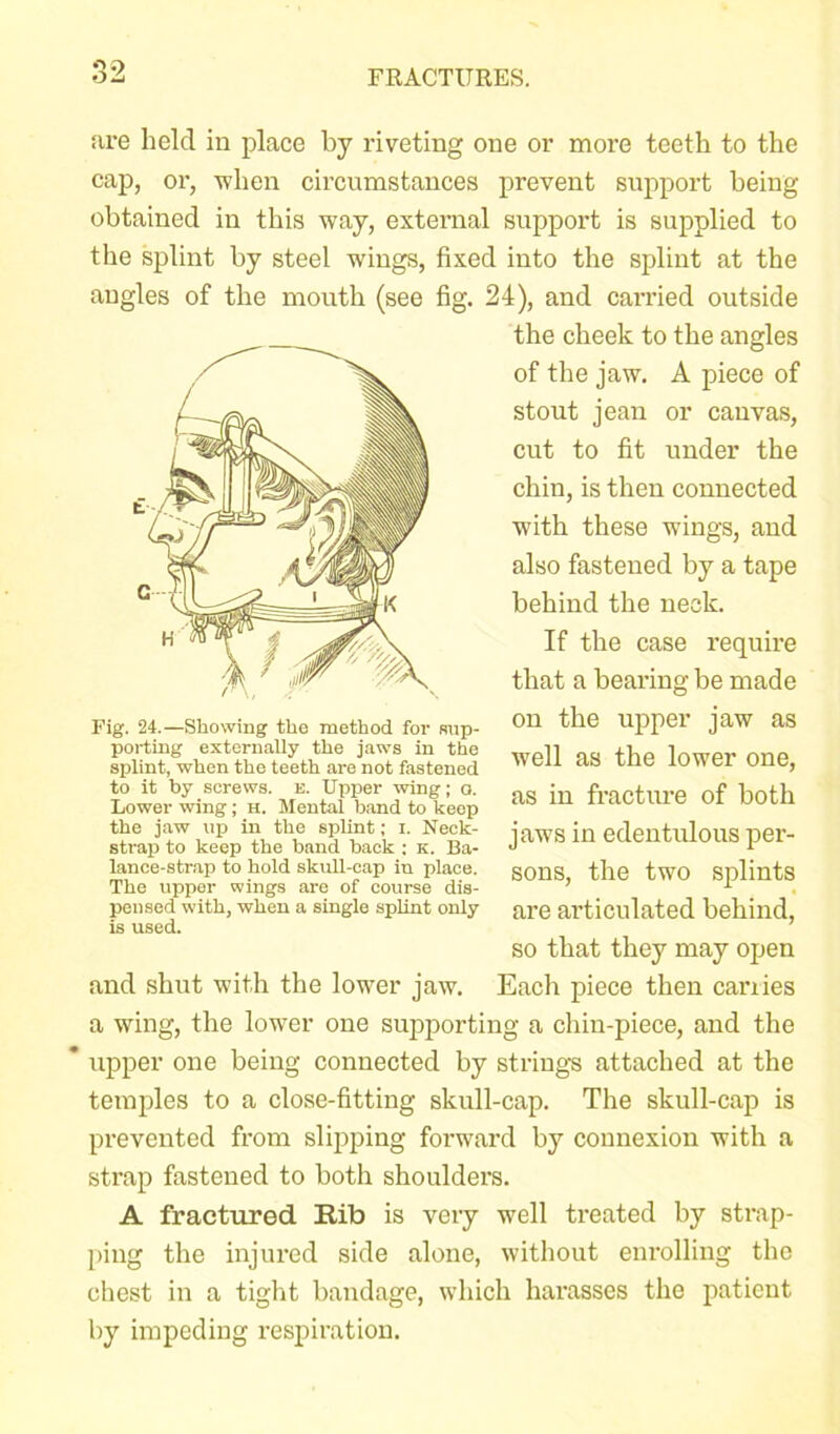 are held in place by riveting one or more teeth to the cap, or, -when circumstances prevent support being obtained in this way, external support is supplied to the splint by steel wings, fixed into the splint at the angles of the mouth (see fig. 24), and carried outside the cheek to the angles of the jaw. A piece of stout jean or canvas, cut to fit under the chin, is then connected with these wings, and also fastened by a tape behind the neck. If the case require that a bearing be made Fig. 24.—Showing the method for sup- porting externally the jaws in the splint, when the teeth are not fastened to it by screws. K. Upper wing; o. Lower wing ; h. Mental band to keep the jaw up in the splint; i. Neck- strap to keep the band back : K. Ba- lance-strap to hold skull-cap in place. The upper wings are of course dis- pensed with, when a single splint only is used. and shut with the lower jaw. on the upper jaw as well as the lower one, as in fracture of both jaws in edentulous per- sons, the two splints are articulated behind, so that they may open Each piece then canies a wing, the lower one supporting a chin-piece, and the * upper one being connected by strings attached at the temples to a close-fitting skull-cap. The skull-cap is prevented from slipping foi’ward by connexion with a strap fastened to both shoulders. A fractured Rib is very well treated by strap- ping the injured side alone, without enrolling the chest in a tight bandage, which harasses the patient by impeding respiration.