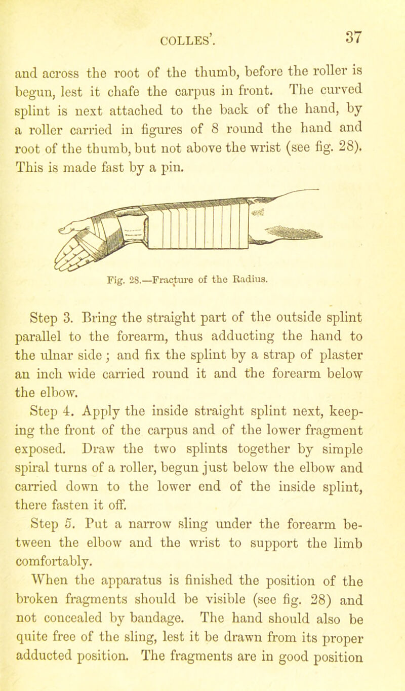 and across the root of the thumb, before the roller is begun, lest it chafe the carpus in front. The curved splint is next attached to the back of the hand, by a roller carried in figures of 8 round the hand and root of the thumb, but not above the wrist (see fig. 28). This is made fast by a pin. Step 3. Bring the straight part of the outside splint parallel to the forearm, thus adducting the hand to the ulnar side ; and fix the splint by a strap of plaster an inch wide carried round it and the forearm below the elbow. Step 4. Apply the inside straight splint next, keep- ing the front of the carpus and of the lower fragment exposed. Draw the two splints together by simple spiral turns of a roller, begun just below the elbow and carried down to the lower end of the inside splint, there fasten it off. Step 5. Put a narrow sling under the forearm be- tween the elbow and the wrist to support the limb comfortably. When the apparatus is finished the position of the broken fragments should be visible (see fig. 28) and not concealed by bandage. The hand should also be quite free of the sling, lest it be drawn from its proper adducted position. The fragments are in good position