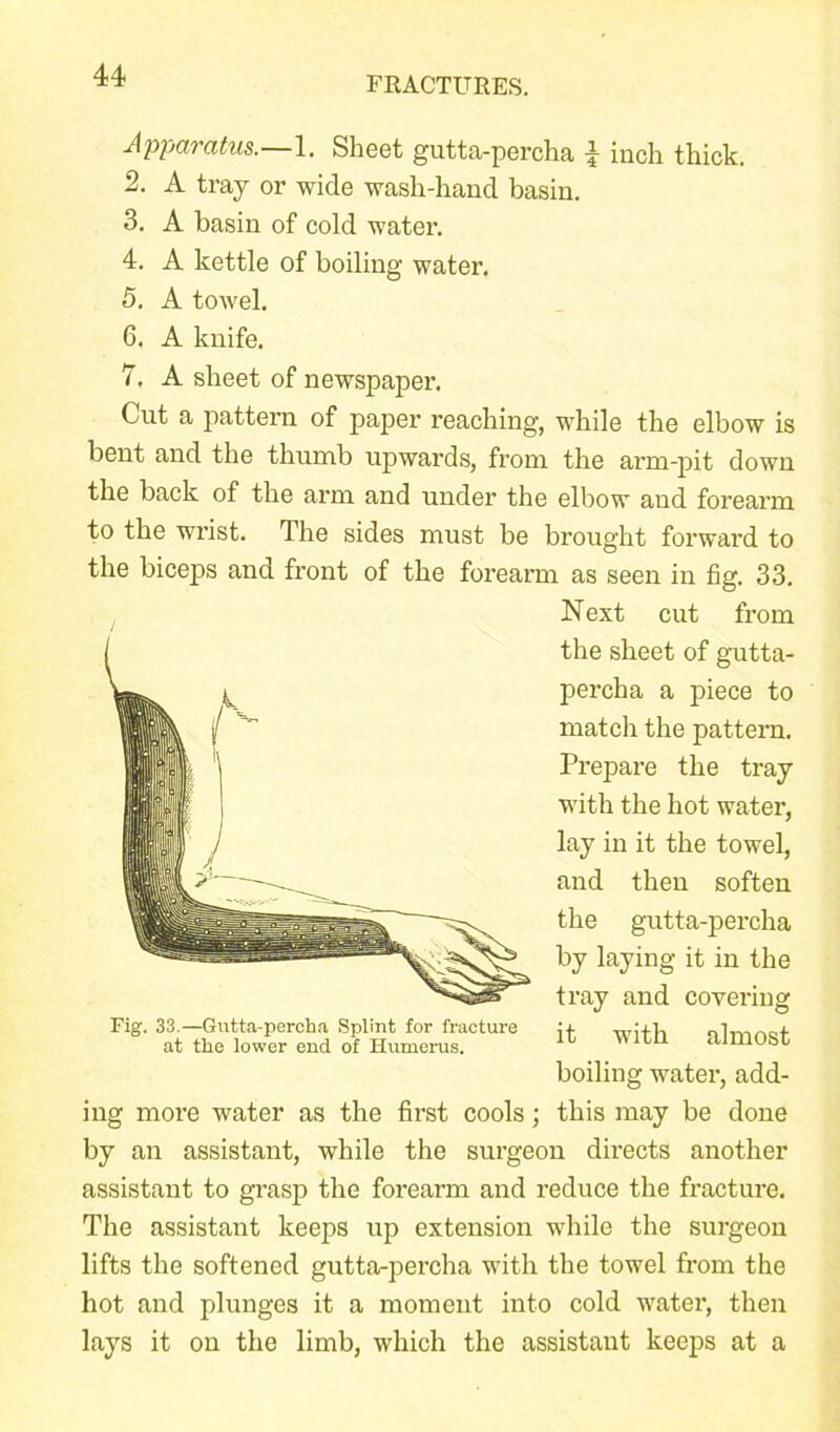 FRACTURES. Apparatus. 1. Sheet gutta-percha 4 inch thick. 2. A tray or wide wash-hand basin. 3. A basin of cold water. 4. A kettle of boiling water. 5. A towel. 6. A knife. 7. A sheet of newspaper. Cut a pattern of paper reaching, while the elbow is bent and the thumb upwards, from the arm-pit down the back of the arm and under the elbow and forearm to the wrist. The sides must be brought forward to the biceps and front of the forearm as seen in fig. 33. N ext cut from the sheet of gutta- percha a piece to match the pattern. Prepare the tray with the hot water, lay in it the towel, and then soften the gutta-percha by laying it in the tray and covering it with almost boiling water, add- ing more water as the first cools; this may be done by an assistant, while the surgeon directs another assistant to grasp the forearm and reduce the fracture. The assistant keeps up extension while the surgeon lifts the softened gutta-percha with the towel from the hot and plunges it a moment into cold water, then lays it on the limb, which the assistant keeps at a Fig. 33.—Gutta-percha Splint for fracture at the lower end of Humerus.