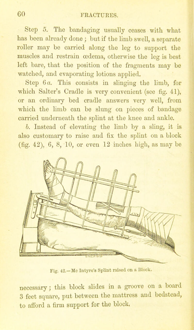 Step 5. The bandaging usually ceases with what has been already done ; but if the limb swell, a separate roller may be carried along the leg to support the muscles and restrain oedema, otherwise the leg is best left bare, that the position of the fragments may be watched, and evaporating lotions applied. Step 6 a. This consists in slinging the limb, for which Salter’s Cradle is very convenient (see fig. 41), or an ordinary bed cradle answers very well, from which the limb can be slung on pieces of bandage can’ied underneath the splint at the knee and ankle. b. Instead of elevating the limb by a sling, it is also customaiy to raise and fix the splint on a block (fig. 42), 6, 8, 10, or even 12 inches high, as may be Fig. 42.—Mo Intyre’s Splint raised on a Block. necessary; this block slides in a groove on a board 3 feet square, put between the mattress and bedstead, to afford a firm support for the block.