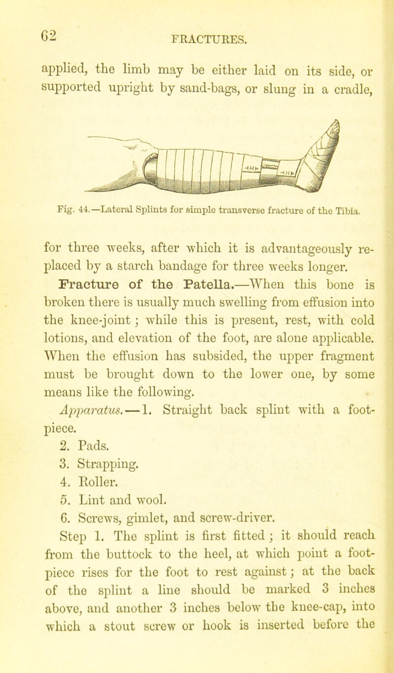 G2 applied, the limb may be either laid on its side, or supported upright by sand-bags, or slung in a cradle, Fig. 44.—Lateral Splints for simple transverse fracture of the Tibia. for three 'weeks, after which it is advantageously re- placed by a starch bandage for three weeks longer. Fracture of the Patella.—When this bone is broken there is usually much swelling from effusion into the knee-joint ; while this is present, rest, with cold lotions, and elevation of the foot, are alone applicable. When the effusion has subsided, the upper fragment must be brought down to the lower one, by some means like the following. Apparatus. — 1. Straight back splint with a foot- piece. 2. Pads. 3. Strapping. 4. Roller. 5. Lint and wool. C. Screws, gimlet, and screw-driver. Step 1. The splint is first fitted ; it should reach from the buttock to the heel, at which point a foot- piece rises for the foot to rest against; at the back of the splint a line should be marked 3 inches above, and another 3 inches below the knee-cap, into which a stout screw or hook is inserted before the