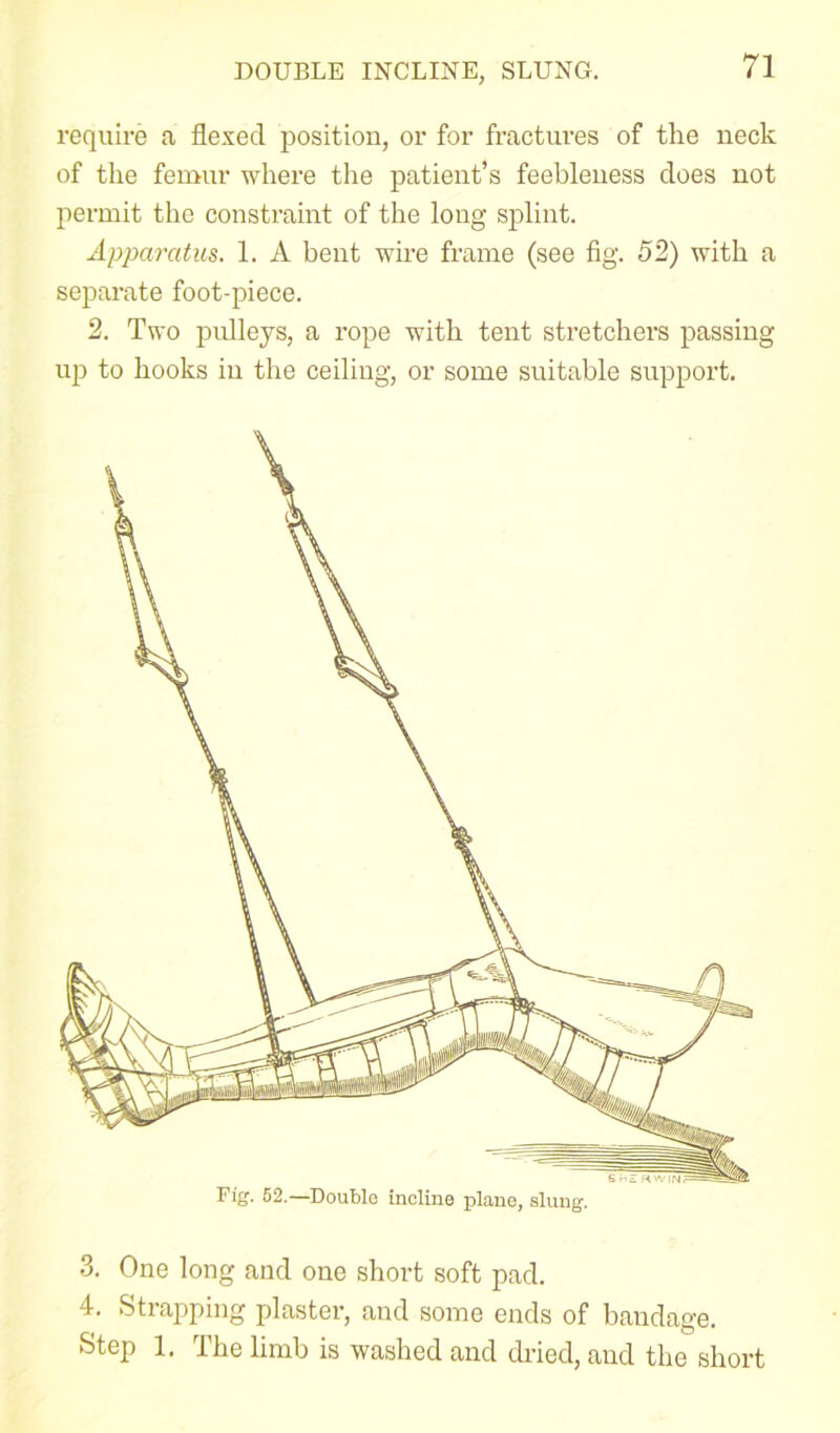 DOUBLE INCLINE, SLUNG. require a flexed position, or for fractures of the neck of the femur where the patient’s feebleness does not permit the constraint of the long splint. Apparatus. 1. A bent wire frame (see fig. 52) with a separate foot-piece. 2. Two pulleys, a rope with tent stretchers passing up to hooks in the ceiling, or some suitable support. Fig. 52.—Double incline plane, slung. 3. One long and one short soft pad. 4. Strapping plaster, and some ends of bandage. Step 1. The limb is washed and dried, and the short