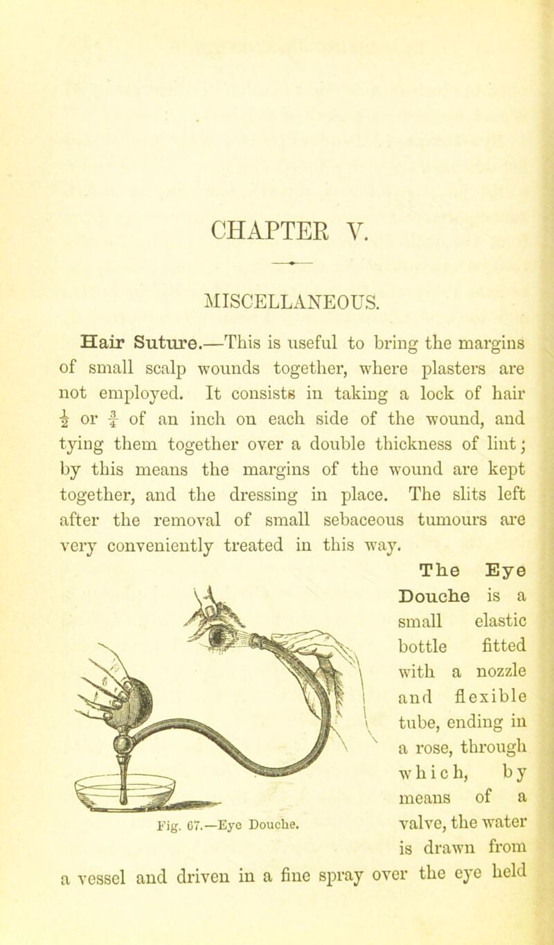 CHAPTER V. MISCELLANEOUS. Hair Suture.—This is useful to bring the margins of small scalp wounds together, where plasters are not employed. It consists in taking a lock of hair 5 or •§■ of an inch on each side of the wound, and tying them together over a double thickness of lint; by this means the margins of the wound are kept together, and the dressing in place. The slits left after the removal of small sebaceous tumours are very conveniently treated in this way. The Eye Douche is a small elastic bottle fitted with a nozzle and flexible tube, ending in a rose, through w li i c h, b y means of a Fig. 67.—Eye Douche. valve, the water is drawn from a vessel and driven in a fine spray over the eye held