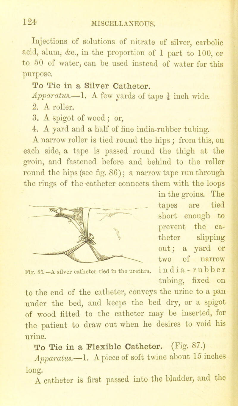 Injections of solutions of nitrate of silver, carbolic acicl, alum, &c., in the proportion of 1 part to 100, or to 50 of water, can be used instead of water for this purpose. To Tie in a Silver Catheter. Apparatus.— 1. A few yards of tape \ inch wide. 2. A roller. 3. A spigot of wood; or, 4. A yard and a half of fine india-rubber tubing. A narrow roller is tied round the hips ; from this, on each side, a tape is passed round the thigh at the groin, and fastened before and behind to the roller round the hips (see fig. 86) j a narrow tape run through the rings of the catheter connects them with the loops in the groins. The tapes are tied short enough to prevent the ca- theter slipping out; a yard or two of naiTow Fig. 86. —A silver catheter tied in the urethra, i U d i a - rubber tubing, fixed on to the end of the catheter, conveys the urine to a pan under the bed, and keeps the bed dry, or a spigot of wood fitted to the catheter may be inserted, for the patient to draw out when he desires to void his urine. To Tie in a Flexible Catheter. (Fig. 87.) Apparatus.—1. Apiece of soft twine about 15 inches long. A catheter is first passed into the bladder, and the