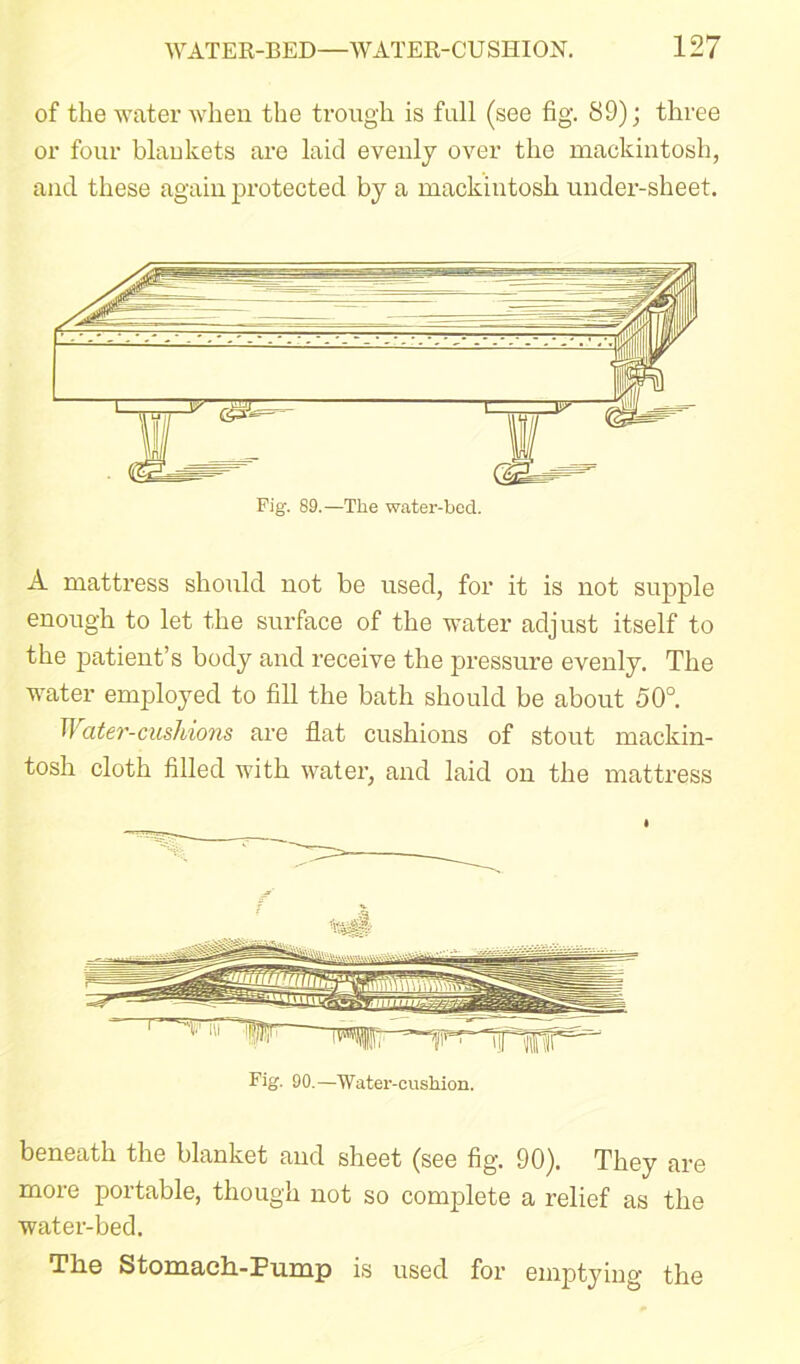 of the water when the trough is full (see fig. S9); three or four blankets are laid evenly over the mackintosh, and these again protected by a mackintosh under-sheet. Fig. 89.—The water-bed. A mattress should not be used, for it is not supple enough to let the surface of the water adjust itself to the patient’s body and receive the pressure evenly. The water employed to fill the bath should be about 50°. Water-cushions are flat cushions of stout mackin- tosh cloth filled with water, and laid on the mattress Fig. 90.—Water-cushion. beneath the blanket and sheet (see fig. 90). They are more portable, though not so complete a relief as the water-bed. The Stomach-Pump is used for emptying the