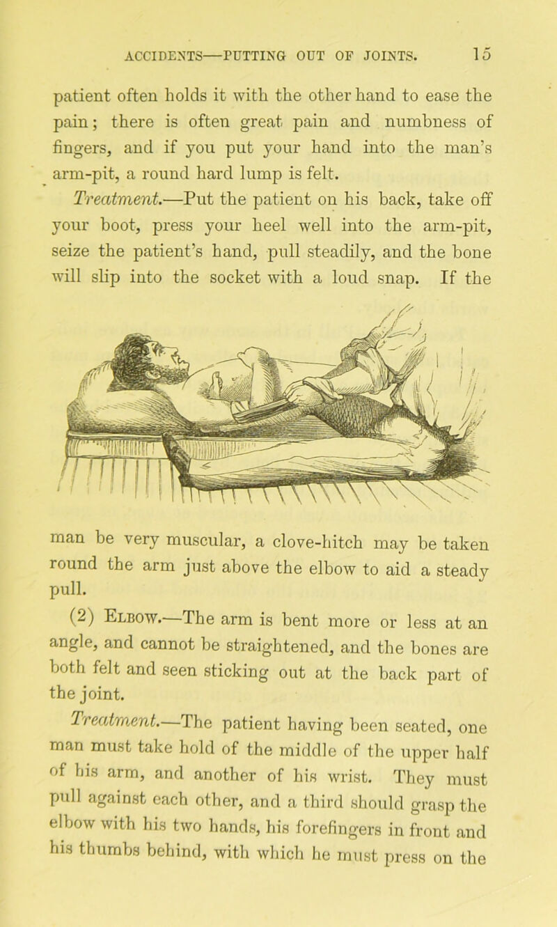 patient often holds it with the other hand to ease the pain; there is often great pain and numbness of fingers, and if you put your hand into the man’s arm-pit, a round hard lump is felt. Treatment.—Put the patient on his back, take off your boot, press your heel well into the arm-pit, seize the patient’s hand, pull steadily, and the bone will slip into the socket with a loud snap. If the man be very muscular, a clove-hitch may be taken round the arm just above the elbow to aid a steady pull. (2) Elbow.—The arm is bent more or less at an angle, and cannot be straightened, and the bones are both felt and seen sticking out at the back part of the joint. Treatment.—The patient having been seated, one man must take hold of the middle of the upper half of his arm, and another of his wrist. They must pull against each other, and a third should grasp the elbow with his two hands, his forefingers in front and his thumbs behind, with which he must press on the