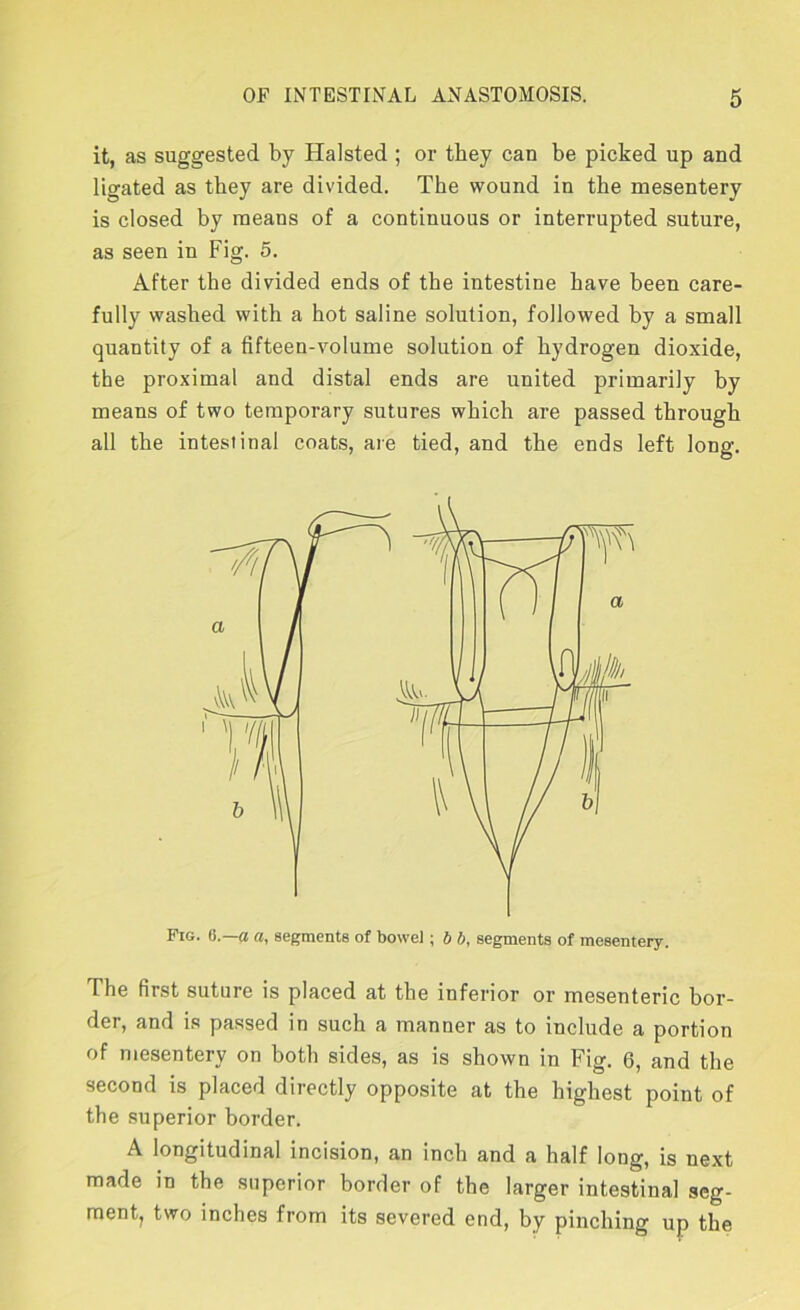 it, as suggested by Halsted ; or they can be picked up and ligated as they are divided. The wound in the mesentery is closed by means of a continuous or interrupted suture, as seen in Fig. 5. After the divided ends of the intestine have been care- fully washed with a hot saline solution, followed by a small quantity of a fifteen-volume solution of hydrogen dioxide, the proximal and distal ends are united primarily by means of two temporary sutures which are passed through all the intestinal coats, are tied, and the ends left long. Pig. 6.—a a, segments of bowel; b b, segments of mesentery. The first suture is placed at the inferior or mesenteric bor- der, and is passed in such a manner as to include a portion of mesentery on both sides, as is shown in Fig. 6, and the second is placed directly opposite at the highest point of the superior border. A longitudinal incision, an inch and a half long, is next made in the superior border of the larger intestinal seg- ment, two inches from its severed end, by pinching up the