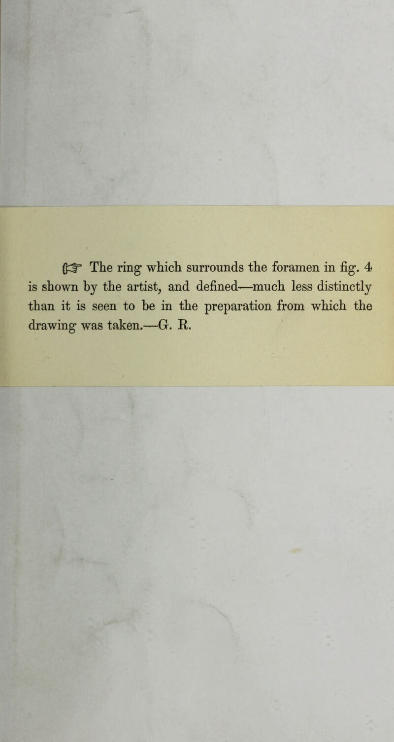 is shown by the artist, and defined—much less distinctly than it is seen to be in the preparation from which the drawing was taken.—G. R.