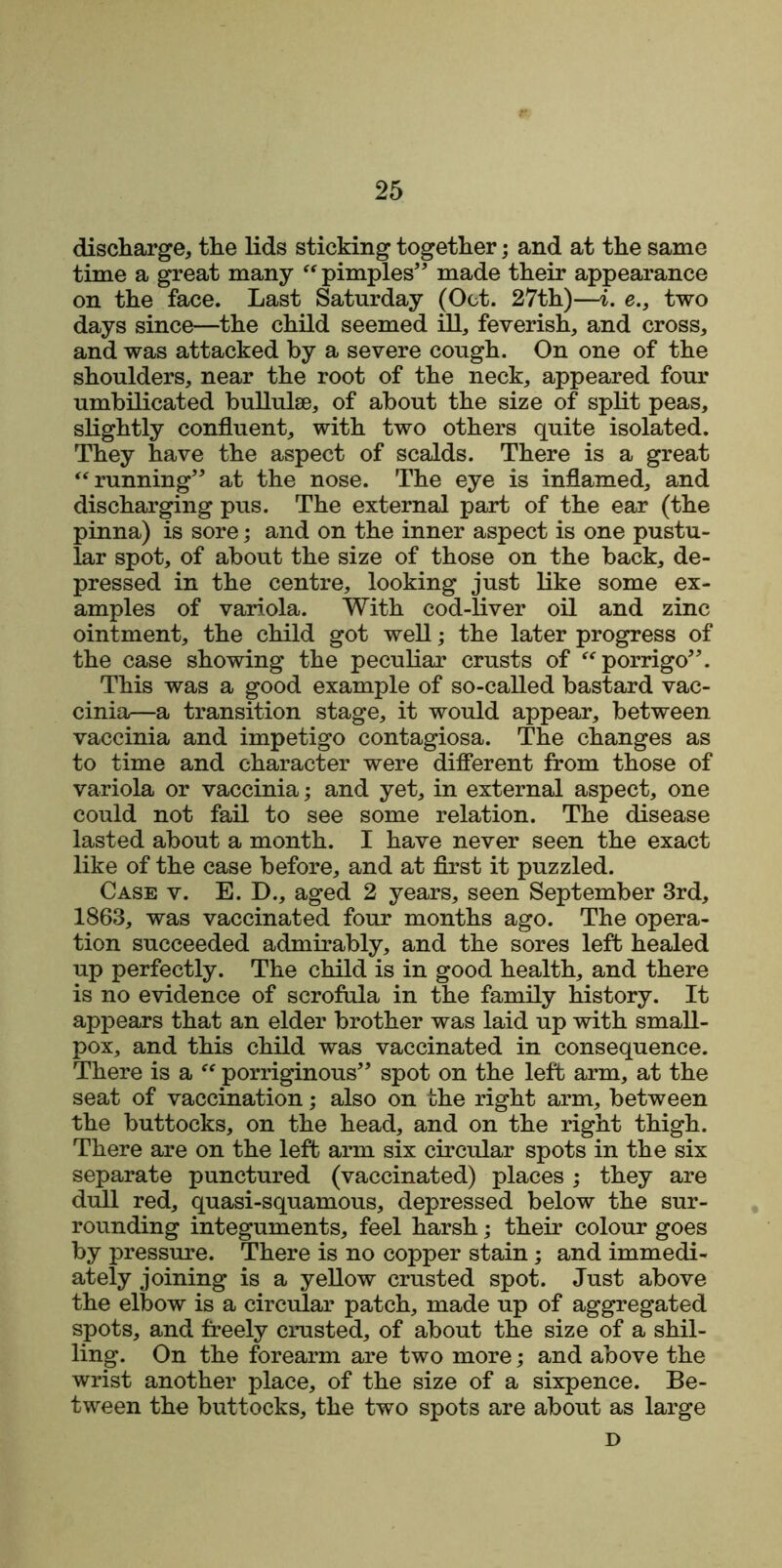 discharge, the lids sticking together; and at the same time a great many “ pimples” made their appearance on the face. Last Saturday (Oct. 27th)—i. e., two days since—the child seemed ill, feverish, and cross, and was attacked by a severe cough. On one of the shoulders, near the root of the neck, appeared four umbilicated bullulse, of about the size of split peas, slightly confluent, with two others quite isolated. They have the aspect of scalds. There is a great “running” at the nose. The eye is inflamed, and discharging pus. The external part of the ear (the pinna) is sore; and on the inner aspect is one pustu- lar spot, of about the size of those on the back, de- pressed in the centre, looking just like some ex- amples of variola. With cod-liver oil and zinc ointment, the child got well; the later progress of the case showing the peculiar crusts of “porrigo”. This was a good example of so-called bastard vac- cinia—a transition stage, it would appear, between vaccinia and impetigo contagiosa. The changes as to time and character were different from those of variola or vaccinia; and yet, in external aspect, one could not fail to see some relation. The disease lasted about a month. I have never seen the exact like of the case before, and at first it puzzled. Case v. E. D., aged 2 years, seen September 3rd, 1863, was vaccinated four months ago. The opera- tion succeeded admirably, and the sores left healed up perfectly. The child is in good health, and there is no evidence of scrofula in the family history. It appears that an elder brother was laid up with small- pox, and this child was vaccinated in consequence. There is a “ porriginous” spot on the left arm, at the seat of vaccination; also on the right arm, between the buttocks, on the head, and on the right thigh. There are on the left arm six circular spots in the six separate punctured (vaccinated) places ; they are dull red, quasi-squamous, depressed below the sur- rounding integuments, feel harsh; their colour goes by pressure. There is no copper stain; and immedi- ately joining is a yellow crusted spot. Just above the elbow is a circular patch, made up of aggregated spots, and freely crusted, of about the size of a shil- ling. On the forearm are two more; and above the wrist another place, of the size of a sixpence. Be- tween the buttocks, the two spots are about as large D